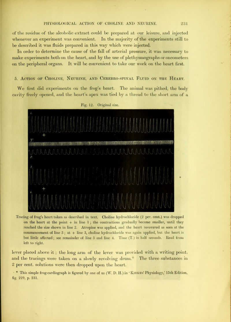 of the residue of the alcoholic extract could be prepared at our leisure, aud injected whenever an experiment was convenient. In the majority of the experiments still to be described it was fluids prepared in this way which were injected. In order to determine the cause of the fall of arterial pressure, it was necessary to make experiments both on the heart, and by the use of plethysmographs or oncometers on the peripheral organs. It will be convenient to take our work on the heart first. 5. Action of Choline, Neurine, and Cerebro-spinal Fluid on the Heart. We first did experiments on the frog’s heart. The animal was pithed, tlie body cavity freely opened, and the heart’s apex was tied by a thread to the short arm of a Fig. 12. Original size. Tracing of frog’s heart taken as described in text. Choline hydrochloride (2 per. cent.) was dropped on the heart at the point + in line 1 ; the contractions gradually became smaller, until they reached the size shown in line 2. Atropine was applied, and the heart recovered as seen at the commencement of line 3 ; at + line 3, choline hydrochloride was again applied, but the heart is but little affected; see remainder of line 3 and line 4. Time (T.) in half seconds. Read from left to right. lever placed above it ; the long arm of the lever was provided with a writing point, and the tracings were taken on a slowly revolving drum.* The three substances in 2 per cent, solutions were then dropped upon the heart. * This simple frog-cardiograph is figured by one of us (W. D. H.) in ‘ Kirkes’ Physiology,’ 15th Edition,