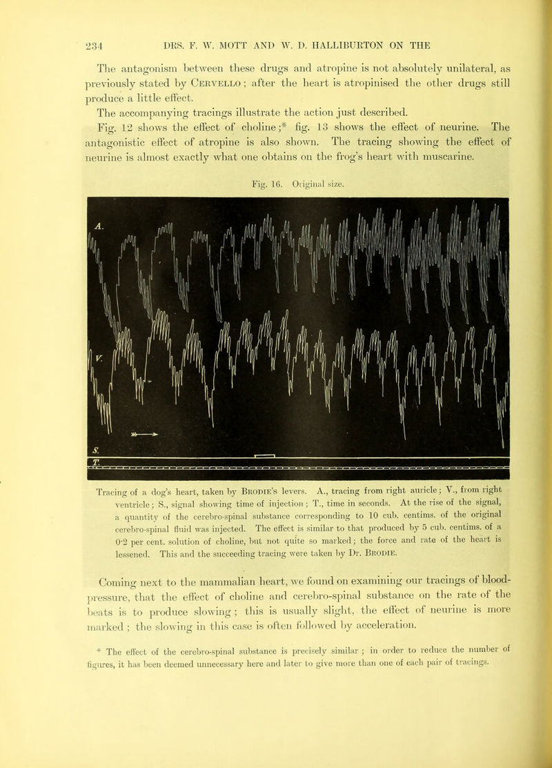 The antagonism between these drugs and atropine is not absolutely unilateral, as previously stated by Cervello ; after the heart is atropiiiised the other drugs still produce a little effect. The accompanying tracings illustrate the action just described. Fig. 12 shows the effect of choline;'^ fig. 13 shows the effect of neurine. The antagonistic effect of atropine is also shown. The tracing showing the effect of neurine is almost exactly what one obtains on the frog’s heart with muscarine. Fig. 16. Original size. Tracing of a dog’s heart, taken by Brodie’s levers. A., tracing from right auricle; V., from right ventricle; S., signal showing time of injection ; T., time in seconds. At the rise of the signal, a quantity of the cerebro-spinal substance corresponding to 10 cub. centims. of the original cerebro-spinal fluid was injected. The effect is similar to that produced by 5 cub. centims. of a 0’2 per cent, solution of choline, but not quite so marked; the force and rate of the heart is lessened. This and the succeeding tracing were taken by Dr. Brodie. Coming next to the mammalian heart, we found on examining our tracings of blood- pressure, that the effect of choline and cerelwo-spinal substance on the rate of the beats is to produce slowing ; this is usually slight, the effect of neuiine is more marked ; the slowing in this case is often followed by acceleration. * The effect of the cerebro-spinal substance is precisely .similar ; in order to reduce the number of figures, it has been deemed unnecessary here and later to give more than one of each pair of tracings.
