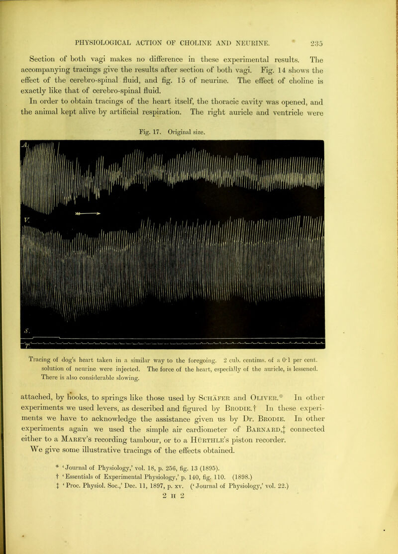 Section of both vagi makes no difference in these experimental results. The accompanying tracings give the results after section of both vagi. Fig. 14 shows the effect of the cerebro-spinal fluid, and fig. 15 of neurine. The effect of choline is exactly like that of cerebro-spinal fluid. In order to obtain tracings of the heart itself, the thoracic cavity was opened, and the animal kept alive by artificial respiration. The right auricle and ventricle were Fig. 17. Original size. Tracing of dog’s heart taken in a similar way to the foregoing. 2 cub. centims. of a OT per cent, solution of neurine were injected. The force of the heart, especially of the auricle, is lessened. There is also considerable slowing. attached, by hooks, to springs like those used by Schafer and Oliver.’’^' In other experiments we used levers, as described and figured by Brodie.I In these experi- ments we have to acknowledge the assistance given us by Dr. Brodie. In other experiments again we used the simple air cardiometer of Barnard,| connected either to a Marey’s recording tambour, or to a Hurthle’s piston recorder. We give some illustrative tracings of the effects obtained. * ‘Journal of Physiology,’ vol. 18, p. 256, fig. 13 (1895). t ‘Essentials of Experimental Physiology,’ p. 140, fig. 110. (1898.) t ‘ Proc. Physiol. Soc.,’ Dec. 11, 1897, p. xv. (‘Journal of Physiology,’ vol. 22.) 2 H 2