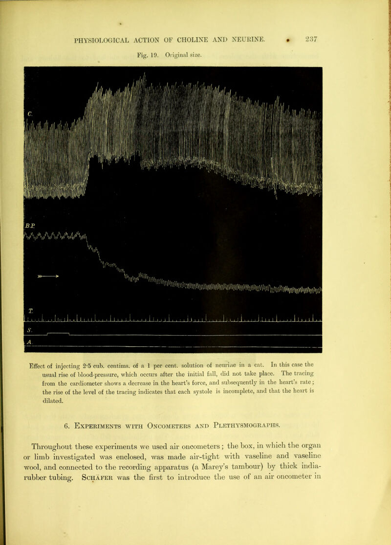 Fig. 19. Original size. Effect of injecting 2'5 cub. centims. of a 1 per cent, solution of neuriiie in a cat. In this case the usual rise of blood-pressure, which occurs after the initial fall, did not take place. The tracing from the cardiometer shows a decrease in the heart’s force, and subsequently in the heart’s rate; the rise of the level of the tracing indicates that each systole is incomplete, and that the heart is dilated. 6. Experiments with Oncometers and Plethysmographs. Throughout these expeiuments we used air oncometers ; the box, in which the organ or limb investigated was enclosed, was made air-tight with vaseline and vaseline wool, and connected to the recording apparatus (a Marey’s tambour) by thick mdia- rubber tubing. Schafer was the first to introduce the use of an air oncometer in
