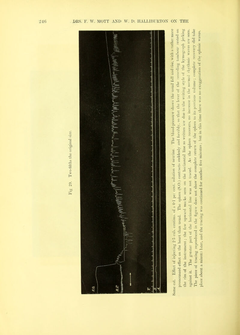 the rim of the instrument; the few upward marks seen on the horizontal line so written are due to the writing style of the kymograph jerking against it. The greater part of the horizontal line was not traced. As the spleen recovers, no increase in the normal rhythmic waves are seen. The piece of tracing reproduced in the figure does not show the complete return of the spleen to its previous volume, complete lecoveiy did take place about a minute later, and the tracing was continued for another five minutes; Imt in this time there was no exaggeiation of the splenic vaies.