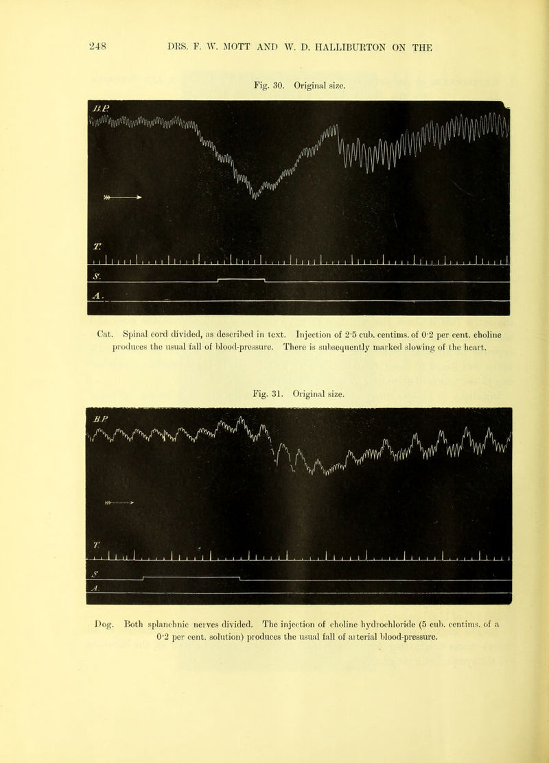 Fig. 30. Original size. Cat. Spinal cord divided, as described in text. Injection of 2’5 cub. centims. of 0‘2 per cent, choline produces the usual fall of blood-pressure. There is subsequently marked slowing of the heart. Fig. 31. Original size. Dog. Both splanchnic nerves divided. The injection of choline hydrochloride (5 cub. centims. of a 0'2 per cent, solution) produces the usual fall of arterial blood-pressure.