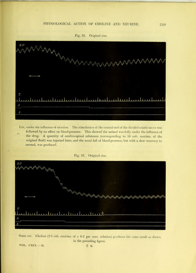 Fig. 32. Oiiginal size. Cat, under tlic influence of nicotine. The stimulation of the central end of the divided sciatic nerve was followed by no effect on blood-pressirre. This showed the animal was fully under the influence of the drug. A quantity of cerebro-spinal substance (corresponding to 10 cub. centims. of the original fluid) was injected later, and the usual fall of blood-pressure, but with a slow rccor'ery to normal, was produced. Fig. 33. Original size. Same cat. Choline (2'5 cub. centims. of a 0‘2 per cent, solution) produces the same result as shown iir the preceding frgrrre.