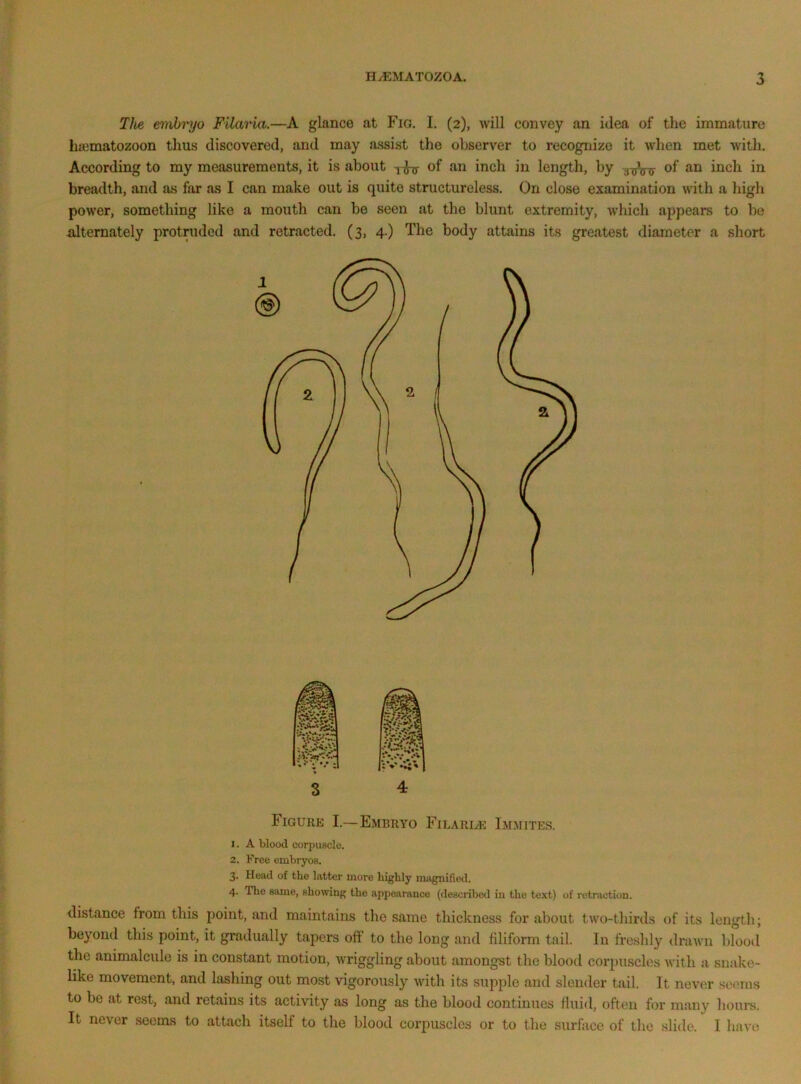 TJie embryo Filaria.—A glance at Fio. I. (2), will convey an idea of the immature hicmatozoon thus discovered, and may assist the observer to recognize it when met with. According to my measurements, it is about of an inch in length, by jjuVrr i^^ch in breadth, and as far as I can make out is quite structureless. On close examination with a high power, something like a mouth can be seen at the blunt extremity, which appears to be idtemately protruded and retracted. (3, 4.) The body attains its greatest diameter a short 3 4 Figuke I.—Embryo FiLARiyE Immites. 1. A blood corpuscle. 2. Free embryos. 3. Head of the latter more highly magnified. 4. The same, showing the appearance (described in the text) of retraction. distance from this point, and maintains the same thickness for about two-thirds of its length; beyond this point, it gradually tapers off to the long and filiform tail. In freshly drawn blood the animalcule is in constant motion, wriggling about amongst the blood corpuscles with a snake- like movement, and lashing out most vigorously with its supple and slender tail. It never seems to be at rest, and retains its activity as long as the blood continues fluid, often for many hours. It never seems to attach itself to the blood corpuscles or to the surface of the slide. I have