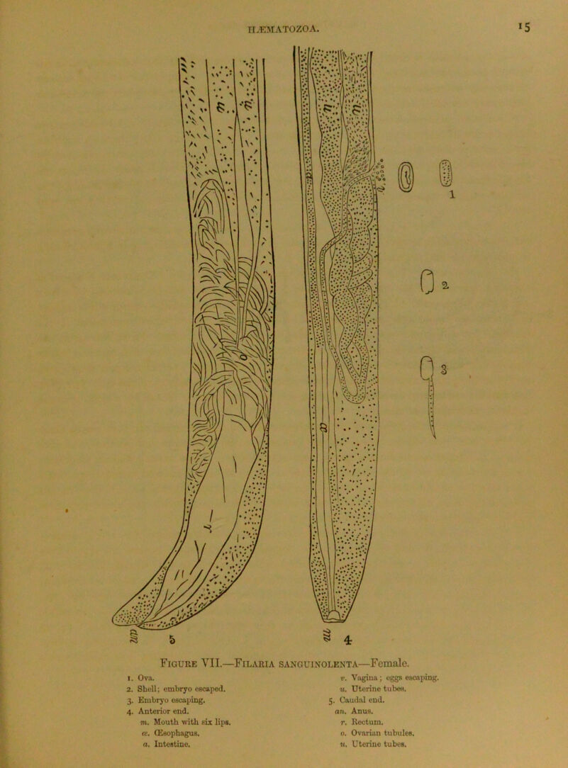 Figure VII.—Filaria sanguinolenta—Female. 1. Ova. 2. Shell; embryo escaped. 3. Embryo escaping. 4. Anterior end. m. Mouth with six lips, a. CEsophagus. a. Intestine. t*. Vivgina; eggs escaping. u. Uterine tubes. 5. Caudal end. aw. Anus, r. Rectum. 0. Ovarian tubules. M. Uterine tubes.