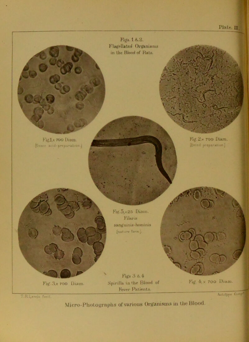 PJalft. m. Fig.3,X 700 Diwm. Spirilla in the Bioo<l of I'iiJ +, x 700 IJiani. Feve!’ Patients. T.R i^Bwis fecit. \licro-PlioLogfaplis of various OrtJ'anisms iii UteBlooti.