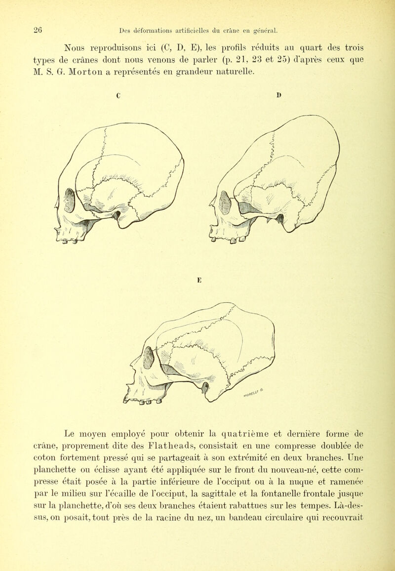 Nous reproduisons ici (C, D, E), les profils réduits au quart des trois types de crânes dont nous venons de parler (p. 21, 23 et 25) d'après ceux que M. S. G. Morton a représentés en grandeur naturelle. C D E Le moyen employé pour obtenir la quatrième et dernière forme de crâne, proprement dite des Flatlieads, consistait en une compresse doublée de coton fortement pressé qui se partageait à son extrémité en deux branches. Une planchette ou éclisse ayant été appliquée sur le front du nouveau-né, cette com- presse était posée à la partie inférieure de l’occiput ou à la nuque et ramenée par le milieu sur l’écaille de l’occiput, la sagittale et la fontanelle frontale jusque sur la planchette, d’où ses deux branches étaient rabattues sur les tempes. Là-des- sus, on posait, tout près de la racine du nez, un bandeau circulaire qui recouvrait