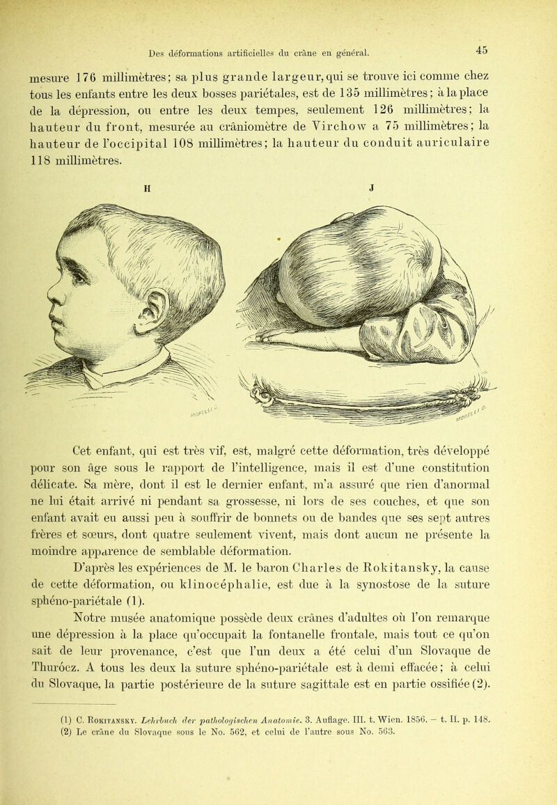 mesure 176 millimètres; sa plus grande largeur,qui se trouve ici comme chez tous les entants entre les deux bosses pariétales, est de 135 millimètres; à la place de la dépression, ou entre les denx tempes, seulement 126 millimètres; la hauteur du front, mesurée au crâniomètre de Virchow a 75 millimètres; la hauteur de l’occipital 108 millimètres; la hauteur du conduit auriculaire 118 millimètres. Cet enfant, qui est très vif, est, malgré cette déformation, très développé pour son âge sous le rapport de l’intelligence, mais il est d’nne constitntion délicate. Sa mère, dont il est le dernier enfant, m’a assuré qne rien d’anormal ne lui était arrivé ni pendant sa grossesse, ni lors de ses conches, et que son enfant avait eu aussi peu à souffrir de bonnets on de bandes que ses sept autres frères et sœurs, dont quatre seulement vivent, mais dont aucnn ne présente la moindre apparence de semblable déformation. D’après les expériences de M. le baron Charles de Rokitansky, la cause de cette déformation, ou klinocéphalie, est due à la synostose de la snture sphéno-pariétale (1). Notre mnsée anatomique possède deux crânes d’adultes où l’on remarque une dépression à la place qu’occupait la fontanelle frontale, mais tont ce qn’on sait de leur provenance, c’est que l’un deux a été celui d’un Slovaque de Thurôcz. A tous les deux la suture sphéno-pariétale est à demi effacée ; à celui du Slovaque, la partie postérieure de la suture sagittale est en partie ossifiée (2). fl) G. Rokitansky. Lehrhuch (1er pathologîschen Anatomie. 3. Aufiage. III. t. Wien. 1856. — t. II. p. 148. (2) Le crâne du Slovacpie sons le No. 562, et celui de l’autre sou.s No. 563.