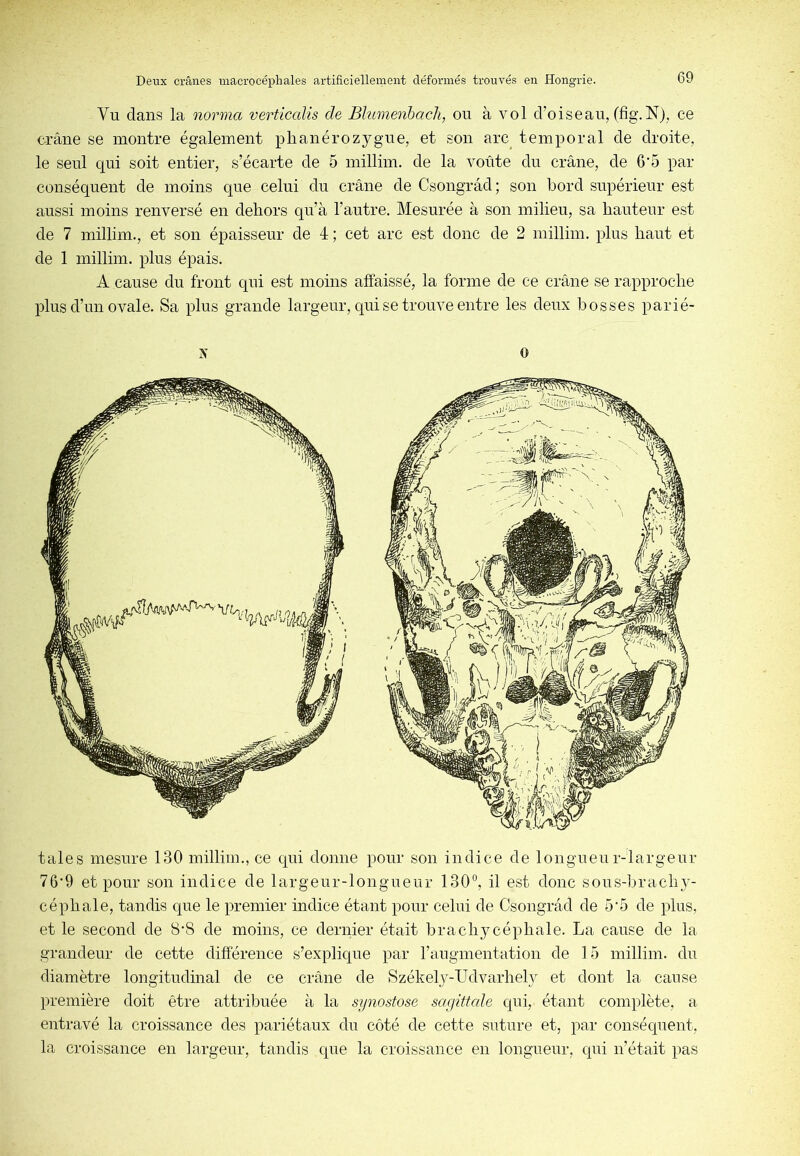 Vu dans la norma verticalis de Blumenhach, ou à vol d’oiseau, (fig.N), ce crâne se montre également plianérozygue, et son arc^ temporal de droite, le seul qui soit entier, s’écarte de 5 millim. de la voûte du crâne, de 6'5 par conséquent de moins que celui du crâne de Csongrâd; son bord supérieur est aussi moins renversé en dehors qu’à l’autre. Mesurée à son milieu, sa hauteur est de 7 millim., et son épaisseur de 4 ; cet arc est donc de 2 millim. plus haut et de 1 millim. plus épais. A cause du front qui est moins affaissé, la forme de ce crâne se rapproche plus d’un ovale. Sa plus grande largeur, qui se trouve entre les deux bosses parié- tales mesure 130 millim., ce qui donne pour son indice de longueur-largeur 76‘9 et pour son indice de largeur-longueur 130°, il est donc sous-brach}- céphale, tandis que le premier indice étant pour celui de Csongrâd de 5‘5 de plus, et le second de 8'8 de moins, ce dernier était brachj^céphale. La cause de la grandeur de cette différence s’explique par l’augmentation de 15 millim. du diamètre longitudinal de ce crâne de Székelj-Udvarhel}^ et dont la cause première doit être attribuée à la sijnostose sacjittcde qui, étant complète, a entravé la croissance des pariétaux du côté de cette suture et, par conséquent, la croissance en largeur, tandis que la croissance en longueur, qui n’était pas