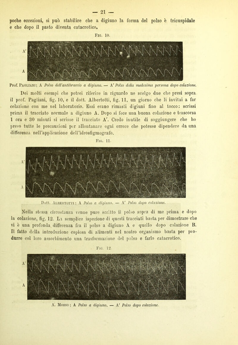 poche eccezioni, si può stabilire che a digiuno la forma del polso è tricuspidale e che dopo il pasto diventa catacrotico. Fio. IO. A' A Prof. Pagliani ; A Polso dell'antibraccio a digiuno. — A' Polso della medesima persona dopo colazione. Dei molti esempi che potrei riferire in riguardo ne scelgo due che presi sopra il prof. Pagliani, fig. 10, e il dott. Àlbertotti, fig. 11, un giorno che li invitai a far colazione con me nel laboratorio. Essi erano rimasti digiuni fino al tocco: scrissi prima il tracciato normale a digiuno A. Dopo si fece una buona colazione e trascorsa 1 ora e 30 minuti si scrisse il tracciato Ah Credo inutile di soggiungere che ho preso tutte le precauzioni per allontanare ogni errore che potesse dipendere da una differenza nell’applicazione dell’idrosfigmografo. Fig. 11. Dott. Àlbertotti : A Polso a digiuno. — A' Polso dopo colazione. Nella stessa circostanza venne pure scritto il polso sopra di me prima e dopo la colazione, fig. 12. La semplice ispezione di questi tracciati basta per dimostrare che vi è una profonda differenza fra il polso a digiuno A e quello dopo colazione B. Il fatto della introduzione copiosa di alimenti nel nostro organismo basta per pro- durre col loro assorbimento una trasformazione del polso e farlo catacrotico. A. Mosso ; A Polso a digiuno. — A' Polso dopo colazione.