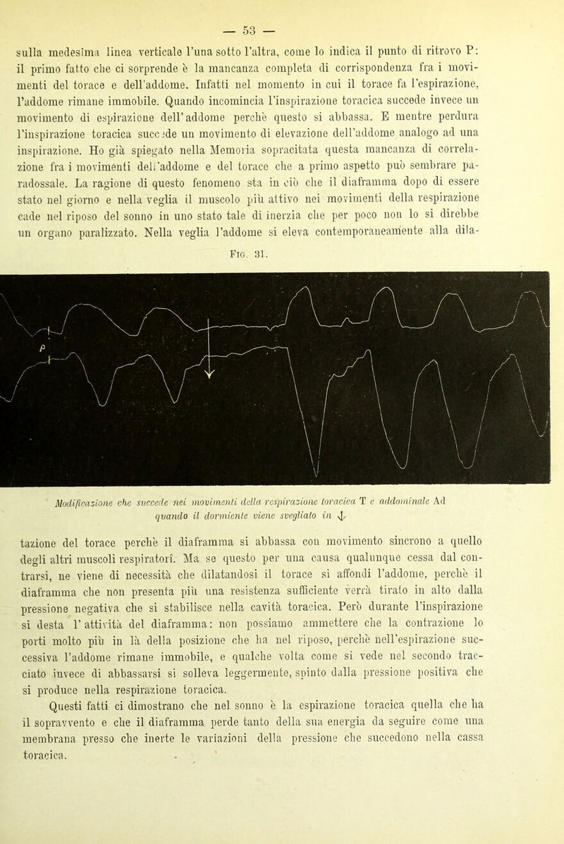 sulla medesima linea verticale l’una sotto l’altra, come lo indica il punto di ritrovo P: il primo fatto che ci sorprende è la mancanza completa di corrispondenza fra i movi- menti del torace e dell’addome. Infatti nel momento in cui il torace fa l’espirazione, l’addome rimane immobile. Quando incomincia l’inspirazione toracica succede invece un movimento di espirazione dell’addome perchè questo si abbassa. E mentre perdura l’inspirazione toracica succide un movimento di elevazione dell’addome analogo ad una inspirazione. Ho già spiegato nella Memoria sopracitata questa mancanza di correla- zione fra i movimenti dell’addome e del torace che a primo aspetto può sembrare pa- radossale. La ragione di questo fenomeno sta in ciò che il diaframma dopo di essere stato nel giorno e nella veglia il muscolo più attivo nei movimenti della respirazione cade nel riposo del sonno in uno stato tale di inerzia che per poco non lo si direbbe un organo paralizzato. Nella veglia l’addome si eleva contemporaneamente alla dila- Fig. 31. Modificazione che succede nei movimenti della respirazione toracica T e addominale Ad quando il dormiente viene sveglialo in d' fazione del torace perchè il diaframma si abbassa con movimento sincrono a quello degli altri muscoli respiratori. Ma se questo per una causa qualunque cessa dal con- trarsi, ne viene di necessità che dilatandosi il torace si affondi l’addome, perchè il diaframma che non presenta più una resistenza sufficiente verrà tiralo in alto dalla pressione negativa che si stabilisce nella cavità toracica. Però durante l’inspirazione si desta l’attività del diaframma: non possiamo ammettere che la contrazione lo porti molto più in là della posizione che ha nel riposo, perchè nell’espirazione suc- cessiva l’addome rimane immobile, e qualche volta come si vede nel secondo trac- ciato invece di abbassarsi si solleva leggermente, spinto dalla pressione positiva che si produce nella respirazione toracica. Questi fatti ci dimostrano che nel sonno è la espirazione toracica quella che ha il sopravvento e che il diaframma perde tanto della sua energia da seguire come una membrana presso che inerte le variazioni della pressione che succedono nella cassa toracica.