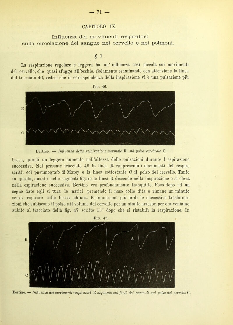 CAPITOLO IX. Influenza dei movimenti respiratori sulla circolazione del sangue nel cervello e nei polmoni. § 1. La respirazione regolare e leggera ha un’ influenza così piccola sui movimenti del cervello, che quasi sfugge all’occhio. Solamente esaminando con attenzione la linea del tracciato 46, vedesi che in corrispondenza della inspirazione vi è una pulsazione più Pig. 46. R C Bertino. — Influenza della respirazione normale R, sul polso cerebrale C- bassa, quindi un leggero aumento nell’altezza delle pulsazioni durante l’espirazione successiva. Nel presente tracciato 46 la linea E rappresenta i movimenti del respiro scritti col pneumografo di Marey e la linea sottostante C il polso del cervello. Tanto in questa, quanto nelle seguenti figure la linea E discende nella inspirazione e si eleva nella espirazione successiva. Bertino era profondamente tranquillo. Poco dopo ad un segno dato egli si tura le narici premendo il naso colle dita e rimane un minuto senza respirare colla bocca chiusa. Esamineremo più tardi le successive trasforma- zioni che subiscono il polso e il volume del cervello per un simile arresto; per ora veniamo subito al tracciato della fig. 47 scritto 15 dopo che si ristabilì la respirazione. In Fio. 47. R C Bertino.— Influenza dei movimenti respiratori R alquanto più forli dei normali sul polso del cervello C.