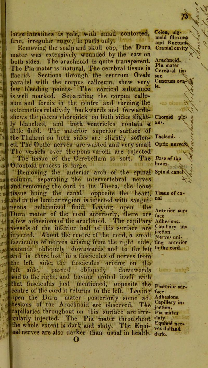 7S'. -VT large intestines is ^alc, with small contorted, firm, irregular rug®, in parts only'. Removing the scalp and skull cap, the Dura mater was extensively wounded by the saw on both sides. The arachnoid is quite transparent. The Pia mater is natural. The cerebral tissue is flaccid. Sections through the centrum Ovale parallel with the corpus callosum, shew very few bleeding points- The cortical substance is well marked. Separating the corpus callo- sum and fornix in the centre and turning the oxtremeties relatively backwards and forwards- shews the plexus choroidcs on both sides Slight- ly blanched, and both ventricles contain a little fluid. The anterior superior surface of the Thalami on both sides are slightly soften- ed. The Optic nerves are wasted and very small The vessels over the pons varolii are injected The tissue of the Cerebellum is soft. The Odontoid process is large. Removing the anterior arch of the spinal column, separating 'the intervertebral nerves and removing the cord in its Theca, the loose tissue lining the canal opposite the heart, and ih the lumbar region is injected with sangui- neous gelatinized fluid. Laying open the Dura mater of the cord anteriorly, there are a few adhesions of the arachnoid. The capihary vessels of the inferior half of this surface are injected. About the centre of the cord, a small fasciculus of nerves arising from the right side, xtends obliquely downwards and to the left 'nd is there lost in a fasciculus of nerves from the left side; the fasciculus arising on the eft side, passed obliquely downwards and to the right, and having united itself with that fasciculus just mentioned, opposite the centre of the cord it returns to the left. Laying ipen the Dura mater posteriorly some ad-‘ hesions of the Arachnoid are observed, The capillaries throughout on this surface are irre- gularly injected. The Pia mater throughout he whole extent is dark and slaty. The Equi- al nerves are also darker than usual in health. C-oloB, llg- mold fllexure ^ and Ructunl^x y ^ ,\S\ Cranial cavltyX ^ Arachnoid Pia mater Cerebral tis sue Centrum ovi le. Thalami Optic nervci\  Bare of tha \ brain. >i Spinal canal Tissue of ca- nal Anterior sur- face Adhesions. Capillary in- jection. Nerves uni- ting anterior to the cord. o Posterior sur- face. Adhesions. Capillary in- jection. Pia mater slaty Equina! net- ves dulland dark.