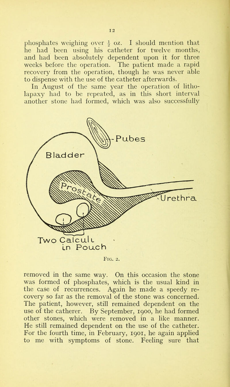 phosphates weighing over \ oz. I should mention that he had been using his catheter for twelve months, and had been absolutely dependent upon it for three weeks before the operation. The patient made a rapid recovery from the operation, though he was never able to dispense with the use of the catheter afterwards. In August of the same year the operation of litho- lapaxy had to be repeated, as in this short interval another stone had formed, which was also successfully Fig. 2. removed in the same way. On this occasion the stone was formed of phosphates, which is the usual kind in the case of recurrences. Again he made a speedy re- covery so far as the removal of the stone was concerned. The patient, however, still remained dependent on the use of the catherer. By September, 1900, he had formed other stones, which were removed in a like manner. He still remained dependent on the use of the catheter. For the fourth time, in February, 1901, he again applied to me with symptoms of stone. Feeling sure that