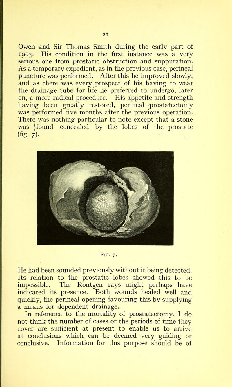 Owen and Sir Thomas Smith during the early part of 1903. His condition in the first instance was a very serious one from prostatic obstruction and suppuration. As a temporary expedient, as in the previous case, perineal puncture was performed. After this he improved slowly, and as there was every prospect of his having to wear the drainage tube for life he preferred to undergo, later on, a more radical procedure. His appetite and strength having been greatly restored, perineal prostatectomy was performed five months after the previous operation. There was nothing particular to note except that a stone was [found concealed by the lobes of the prostate (fig- 7)- Fig. 7. He had been sounded previously without it being detected. Its relation to the prostatic lobes showed this to be impossible. The Rontgen rays might perhaps have indicated its presence. Both wounds healed well and quickly, the perineal opening favouring this by supplying a means for dependent drainage. In reference to the mortality of prostatectomy, I do not think the number of cases or the periods of time they cover are sufficient at present to enable us to arrive at conclusions which can be deemed very guiding or conclusive. Information for this purpose should be of