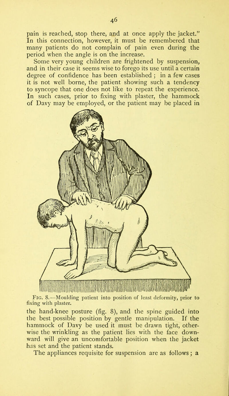 pain is reached, stop there, and at once apply the jacket.” In this connection, however, it must be remembered that many patients do not complain of pain even during the period when the angle is on the increase. Some very young children are frightened by suspension, and in their case it seems wise to forego its use until a certain degree of confidence has been established ; in a few cases it is not well borne, the patient showing such a tendency to syncope that one does not like to repeat the experience. In such cases, prior to fixing with plaster, the hammock of Davy may be employed, or the patient may be placed in Fig. 8.—Moulding patient into position of least deformity, prior to fixing with plaster. the hand-knee posture (fig. 8), and the spine guided into the best possible position by gentle manipulation. If the hammock of Davy be used it must be drawn tight, other- wise the wrinkling as the patient lies with the face down- ward will give an uncomfortable position when the jacket has set and the patient stands. The appliances requisite for suspension are as follows; a