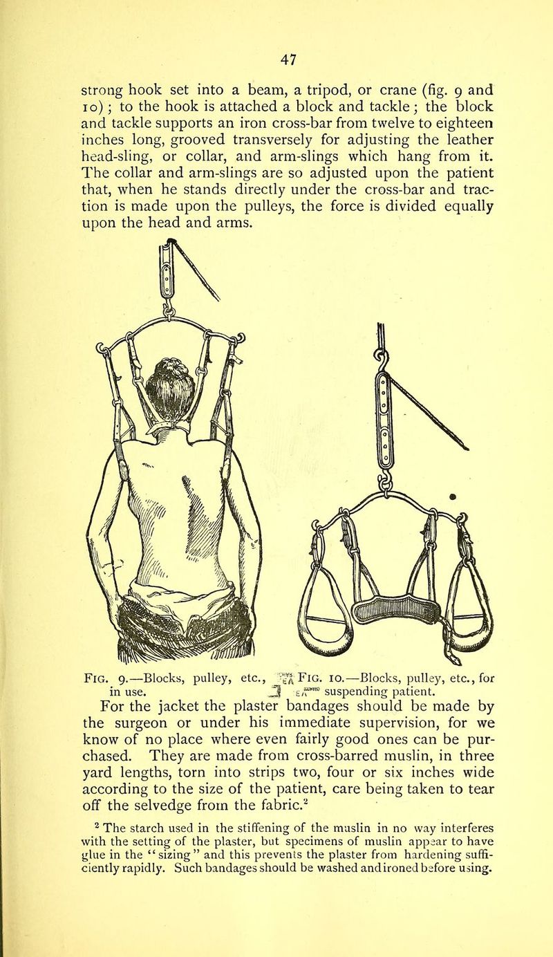 strong hook set into a beam, a tripod, or crane (fig. 9 and 10); to the hook is attached a block and tackle; the block and tackle supports an iron cross-bar from twelve to eighteen inches long, grooved transversely for adjusting the leather head-sling, or collar, and arm-slings which hang from it. The collar and arm-slings are so adjusted upon the patient that, when he stands directly under the cross-bar and trac- tion is made upon the pulleys, the force is divided equally upon the head and arms. Fig. 9.—Blocks, pulley, etc., 'Fig. 10.—Blocks, pulley, etc., for in use. J3 :E/f™ suspending patient. For the jacket the plaster bandages should be made by the surgeon or under his immediate supervision, for we know of no place where even fairly good ones can be pur- chased. They are made from cross-barred muslin, in three yard lengths, torn into strips two, four or six inches wide according to the size of the patient, care being taken to tear off the selvedge from the fabric.2 2 The starch used in the stiffening of the muslin in no way interferes with the setting of the plaster, but specimens of muslin appear to have glue in the “sizing” and this prevents the plaster from hardening suffi- ciently rapidly. Such bandages should be washed and ironed before using.