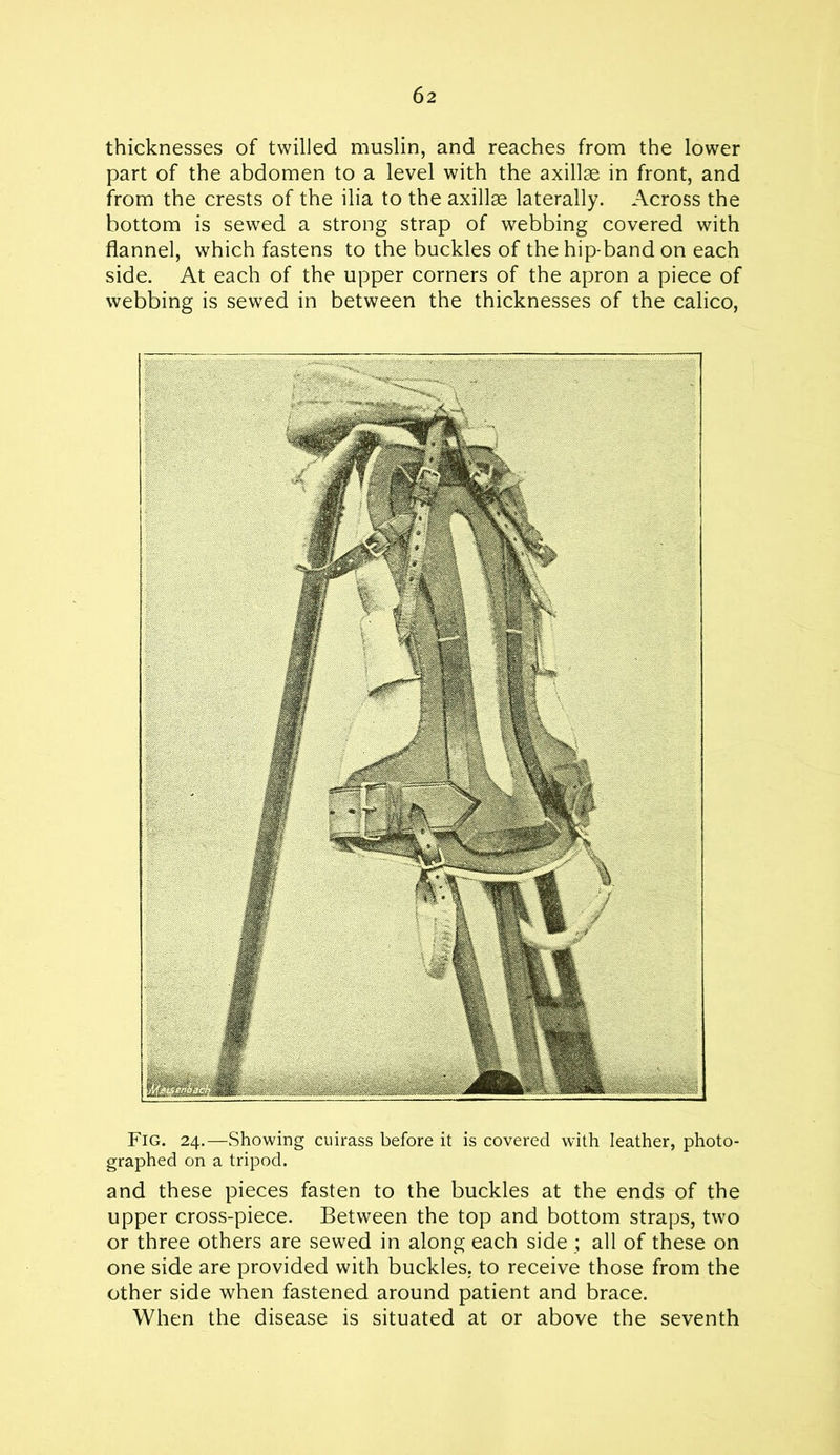 Fig. 24.—Showing cuirass before it is covered with leather, photo- graphed on a tripod. and these pieces fasten to the buckles at the ends of the upper cross-piece. Between the top and bottom straps, two or three others are sewed in along each side ; all of these on one side are provided with buckles, to receive those from the other side when fastened around patient and brace. When the disease is situated at or above the seventh thicknesses of twilled muslin, and reaches from the lower part of the abdomen to a level with the axillae in front, and from the crests of the ilia to the axillae laterally. Across the bottom is sewed a strong strap of webbing covered with flannel, which fastens to the buckles of the hip-band on each side. At each of the upper corners of the apron a piece of webbing is sewed in between the thicknesses of the calico,