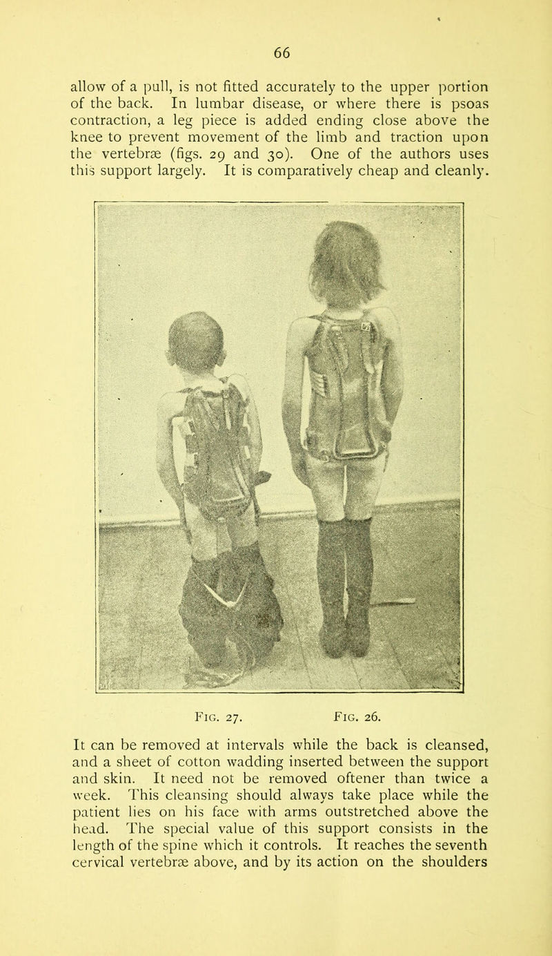allow of a pull, is not fitted accurately to the upper portion of the back. In lumbar disease, or where there is psoas contraction, a leg piece is added ending close above the knee to prevent movement of the limb and traction upon the vertebrae (figs. 29 and 30). One of the authors uses this support largely. It is comparatively cheap and cleanly. Fig. 27. Fig. 26. It can be removed at intervals while the back is cleansed, and a sheet of cotton wadding inserted between the support and skin. It need not be removed oftener than twice a week. This cleansing should always take place while the patient lies on his face with arms outstretched above the head. The special value of this support consists in the length of the spine which it controls. It reaches the seventh cervical vertebrae above, and by its action on the shoulders