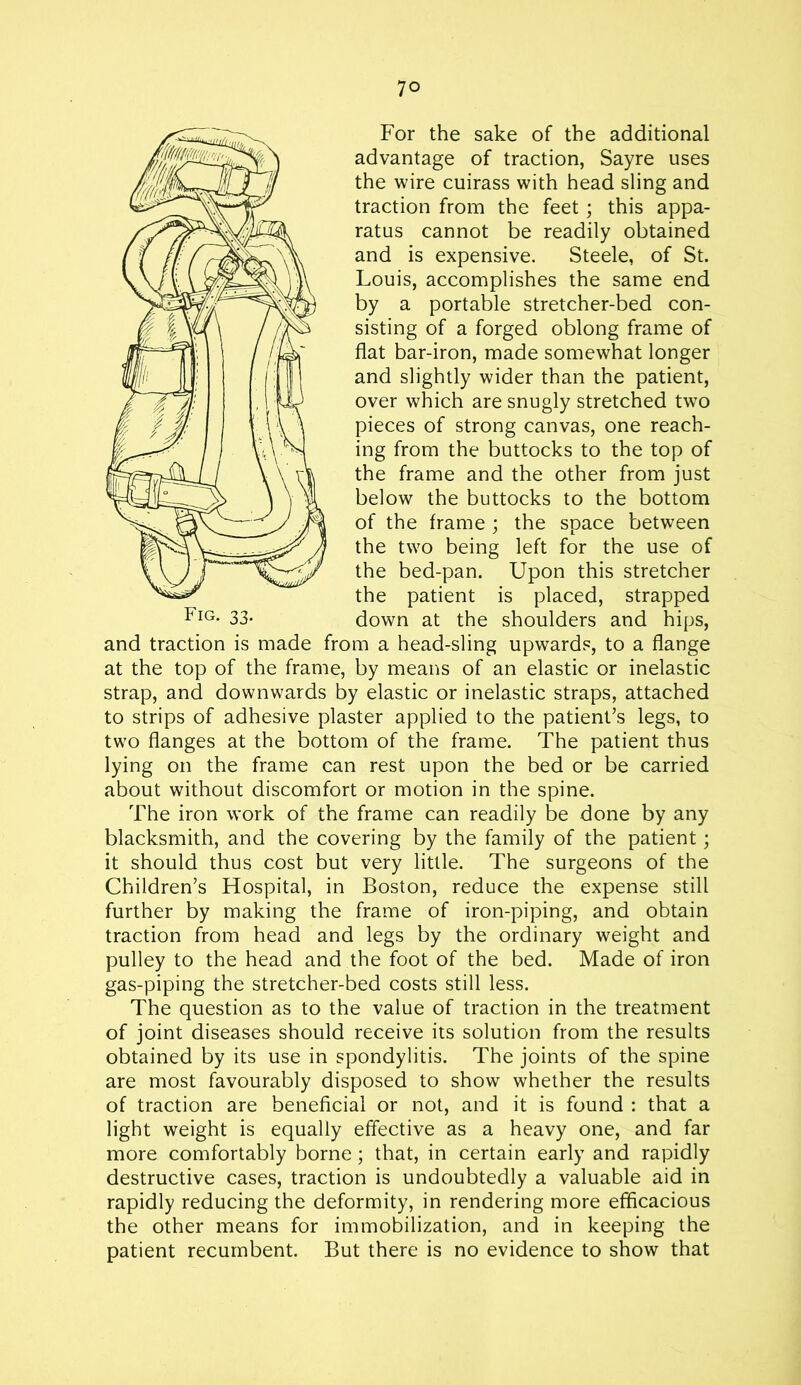 For the sake of the additional advantage of traction, Sayre uses the wire cuirass with head sling and traction from the feet; this appa- ratus cannot be readily obtained and is expensive. Steele, of St. Louis, accomplishes the same end by a portable stretcher-bed con- sisting of a forged oblong frame of flat bar-iron, made somewhat longer and slightly wider than the patient, over which are snugly stretched two pieces of strong canvas, one reach- ing from the buttocks to the top of the frame and the other from just below the buttocks to the bottom of the frame ; the space between the two being left for the use of the bed-pan. Upon this stretcher the patient is placed, strapped down at the shoulders and hips, and traction is made from a head-sling upwards, to a flange at the top of the frame, by means of an elastic or inelastic strap, and downwards by elastic or inelastic straps, attached to strips of adhesive plaster applied to the patient’s legs, to two flanges at the bottom of the frame. The patient thus lying on the frame can rest upon the bed or be carried about without discomfort or motion in the spine. The iron work of the frame can readily be done by any blacksmith, and the covering by the family of the patient; it should thus cost but very little. The surgeons of the Children’s Hospital, in Boston, reduce the expense still further by making the frame of iron-piping, and obtain traction from head and legs by the ordinary weight and pulley to the head and the foot of the bed. Made of iron gas-piping the stretcher-bed costs still less. The question as to the value of traction in the treatment of joint diseases should receive its solution from the results obtained by its use in spondylitis. The joints of the spine are most favourably disposed to show whether the results of traction are beneficial or not, and it is found : that a light weight is equally effective as a heavy one, and far more comfortably borne; that, in certain early and rapidly destructive cases, traction is undoubtedly a valuable aid in rapidly reducing the deformity, in rendering more efficacious the other means for immobilization, and in keeping the patient recumbent. But there is no evidence to show that