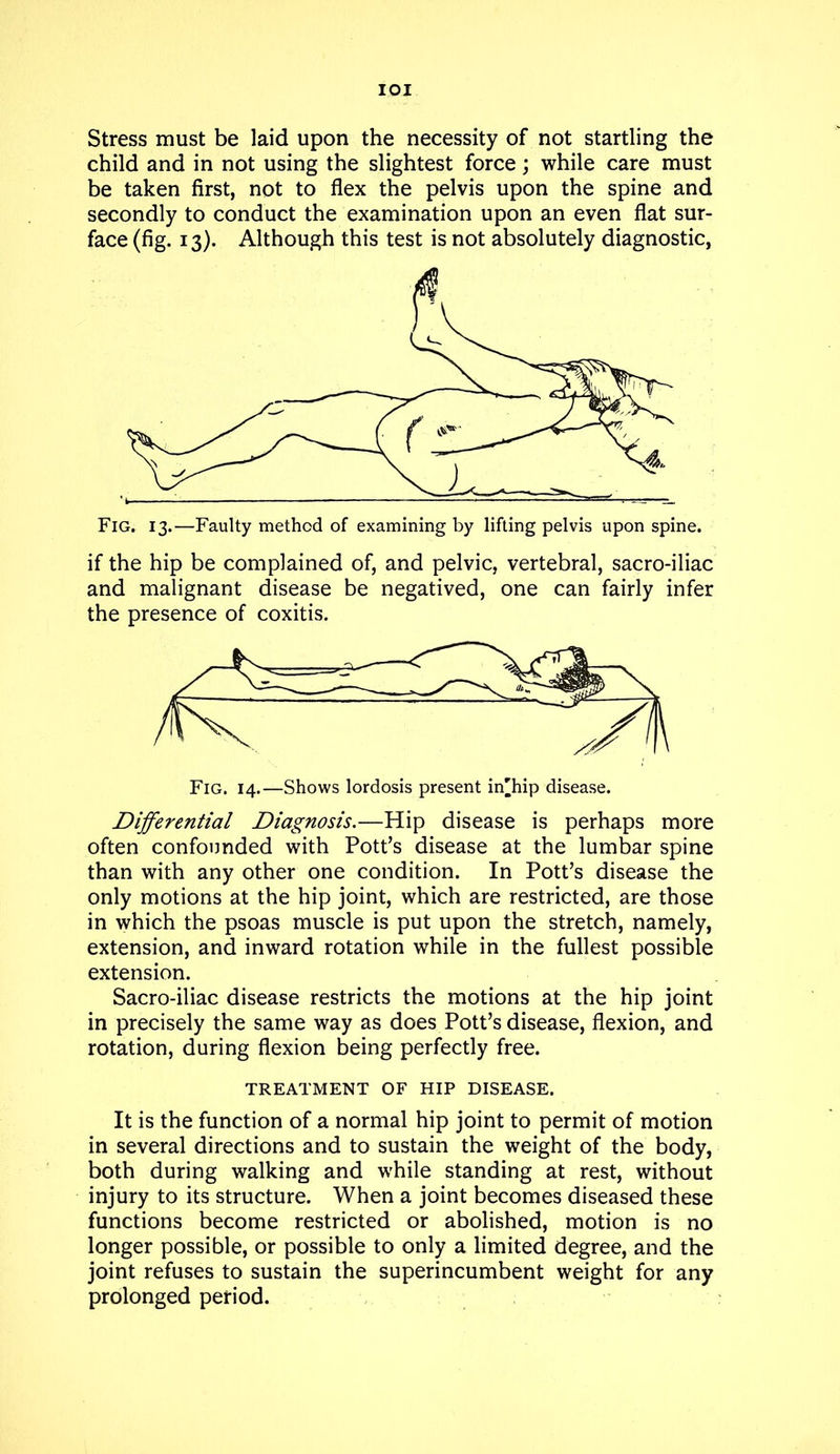 IOI Stress must be laid upon the necessity of not startling the child and in not using the slightest force; while care must be taken first, not to flex the pelvis upon the spine and secondly to conduct the examination upon an even flat sur- face (fig. 13). Although this test is not absolutely diagnostic, if the hip be complained of, and pelvic, vertebral, sacro-iliac and malignant disease be negatived, one can fairly infer the presence of coxitis. Fig. 14.—Shows lordosis present in'hip disease. Differential Diagnosis.—Hip disease is perhaps more often confounded with Pott’s disease at the lumbar spine than with any other one condition. In Pott’s disease the only motions at the hip joint, which are restricted, are those in which the psoas muscle is put upon the stretch, namely, extension, and inward rotation while in the fullest possible extension. Sacro-iliac disease restricts the motions at the hip joint in precisely the same way as does Pott’s disease, flexion, and rotation, during flexion being perfectly free. TREATMENT OF HIP DISEASE. It is the function of a normal hip joint to permit of motion in several directions and to sustain the weight of the body, both during walking and while standing at rest, without injury to its structure. When a joint becomes diseased these functions become restricted or abolished, motion is no longer possible, or possible to only a limited degree, and the joint refuses to sustain the superincumbent weight for any prolonged period.