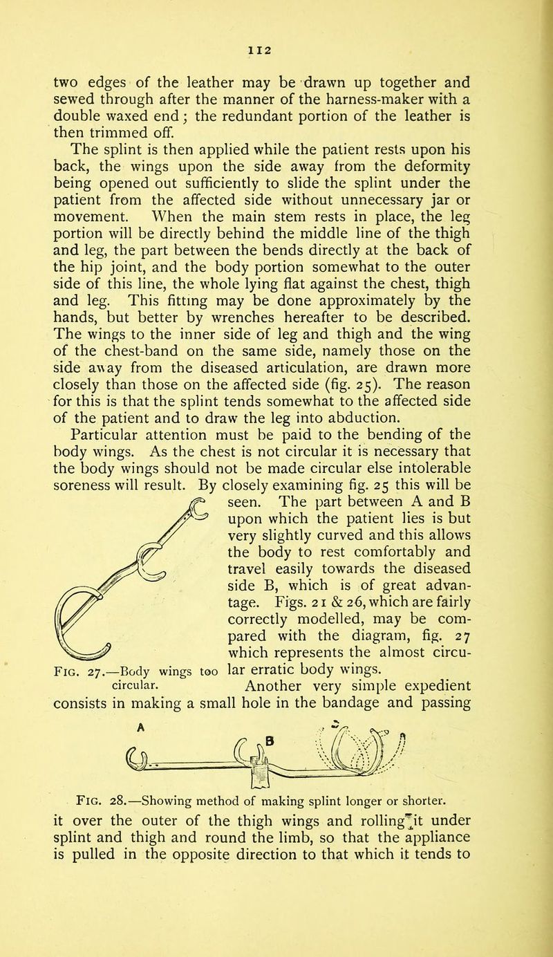 two edges of the leather may be drawn up together and sewed through after the manner of the harness-maker with a double waxed end; the redundant portion of the leather is then trimmed off. The splint is then applied while the patient rests upon his back, the wings upon the side away from the deformity being opened out sufficiently to slide the splint under the patient from the affected side without unnecessary jar or movement. When the main stem rests in place, the leg portion will be directly behind the middle line of the thigh and leg, the part between the bends directly at the back of the hip joint, and the body portion somewhat to the outer side of this line, the whole lying flat against the chest, thigh and leg. This fitting may be done approximately by the hands, but better by wrenches hereafter to be described. The wings to the inner side of leg and thigh and the wing of the chest-band on the same side, namely those on the side away from the diseased articulation, are drawn more closely than those on the affected side (fig. 25). The reason for this is that the splint tends somewhat to the affected side of the patient and to draw the leg into abduction. Particular attention must be paid to the bending of the body wings. As the chest is not circular it is necessary that the body wings should not be made circular else intolerable soreness will result. By closely examining fig. 25 this will be Fig. 27.—Body wings too lar erratic body wings. circular. Another very simple expedient consists in making a small hole in the bandage and passing Fig. 28.—Showing method of making splint longer or shorter, it over the outer of the thigh wings and rolling^it under splint and thigh and round the limb, so that the appliance is pulled in the opposite direction to that which it tends to seen. The part between A and B upon which the patient lies is but very slightly curved and this allows the body to rest comfortably and travel easily towards the diseased side B, which is of great advan- tage. Figs. 21 & 26, which are fairly correctly modelled, may be com- pared with the diagram, fig. 27 wfluch represents the almost circu-