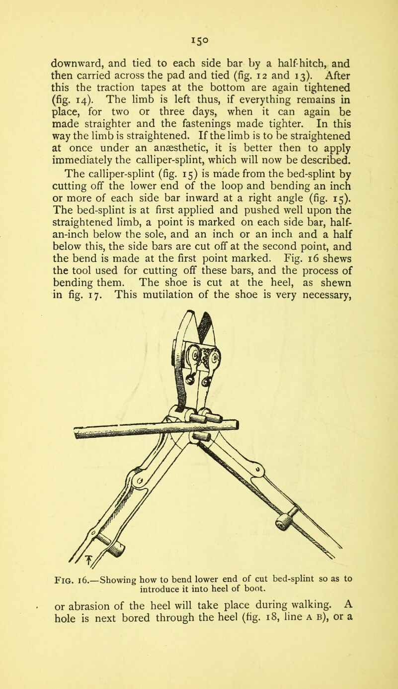 downward, and tied to each side bar by a half-hitch, and then carried across the pad and tied (fig. 12 and 13). After this the traction tapes at the bottom are again tightened (fig. 14). The limb is left thus, if everything remains in place, for two or three days, when it can again be made straighter and the fastenings made tighter. In this way the limb is straightened. If the limb is to be straightened at once under an anaesthetic, it is better then to apply immediately the calliper-splint, which will now be described. The calliper-splint (fig. 15) is made from the bed-splint by cutting off the lower end of the loop and bending an inch or more of each side bar inward at a right angle (fig. 15). The bed-splint is at first applied and pushed well upon the straightened limb, a point is marked on each side bar, half- an-inch below the sole, and an inch or an inch and a half below this, the side bars are cut off at the second point, and the bend is made at the first point marked. Fig. 16 shews the tool used for cutting off these bars, and the process of bending them. The shoe is cut at the heel, as shewn in fig. 17. This mutilation of the shoe is very necessary, or abrasion of the heel will take place during walking. A hole is next bored through the heel (fig. 18, line a b), or a
