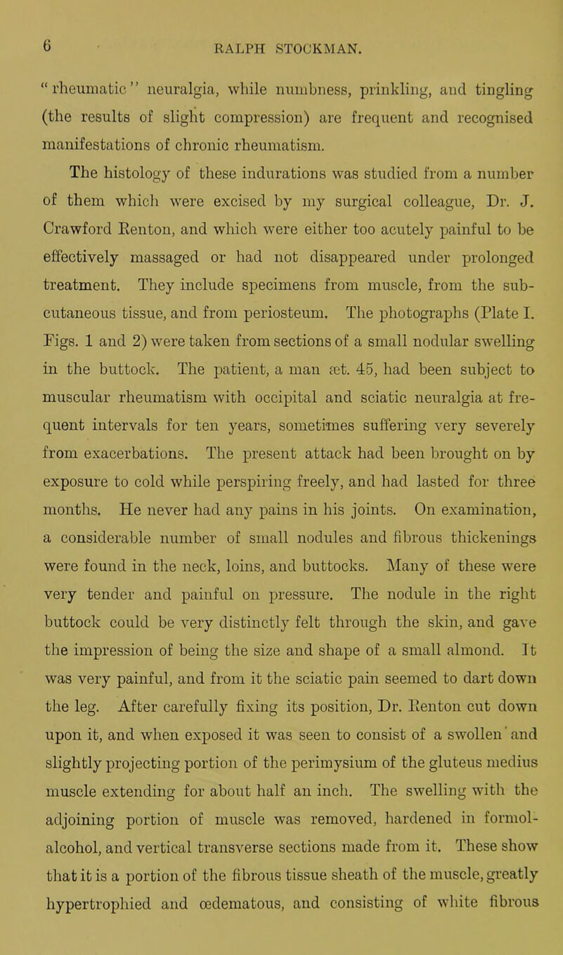 “rheumatic” neuralgia, while numbness, prinkling, and tingling (the results of slight compression) are frequent and recognised manifestations of chronic rheumatism. The histology of these indurations was studied from a number of them which were excised by my surgical colleague, Dr. J. Crawford Eenton, and which were either too acutely painful to be effectively massaged or had not disappeared under prolonged treatment. They include specimens from muscle, from the sub- cutaneous tissue, and from periosteum. The photographs (Plate I. Figs. 1 and 2) were taken from sections of a small nodular swelling in the buttock. The patient, a man jet. 45, had been subject to muscular rheumatism with occipital and sciatic neuralgia at fre- quent intervals for ten years, sometimes suffering very severely from exacerbations. The present attack had been brought on by exposure to cold while perspiring freely, and had lasted for three months. He never had any pains in his joints. On examination, a considerable number of small nodules and fibrous thickenings were found in the neck, loins, and buttocks. Many of these were very tender and painful on pressure. The nodule in the right buttock could be very distinctly felt through the skin, and gave the impression of being the size and shape of a small almond. It was very painful, and from it the sciatic pain seemed to dart down the leg. After carefully fixing its position, Dr. Eenton cut down upon it, and when exposed it was seen to consist of a swollen' and slightly projecting portion of the perimysium of the gluteus medius muscle extending for about half an inch. The swelling with the adjoining portion of muscle was removed, hardened in formol- alcohol, and vertical transverse sections made from it. These show that it is a portion of the fibrous tissue sheath of the muscle, greatly hypertrophied and oedematous, and consisting of white fibrous