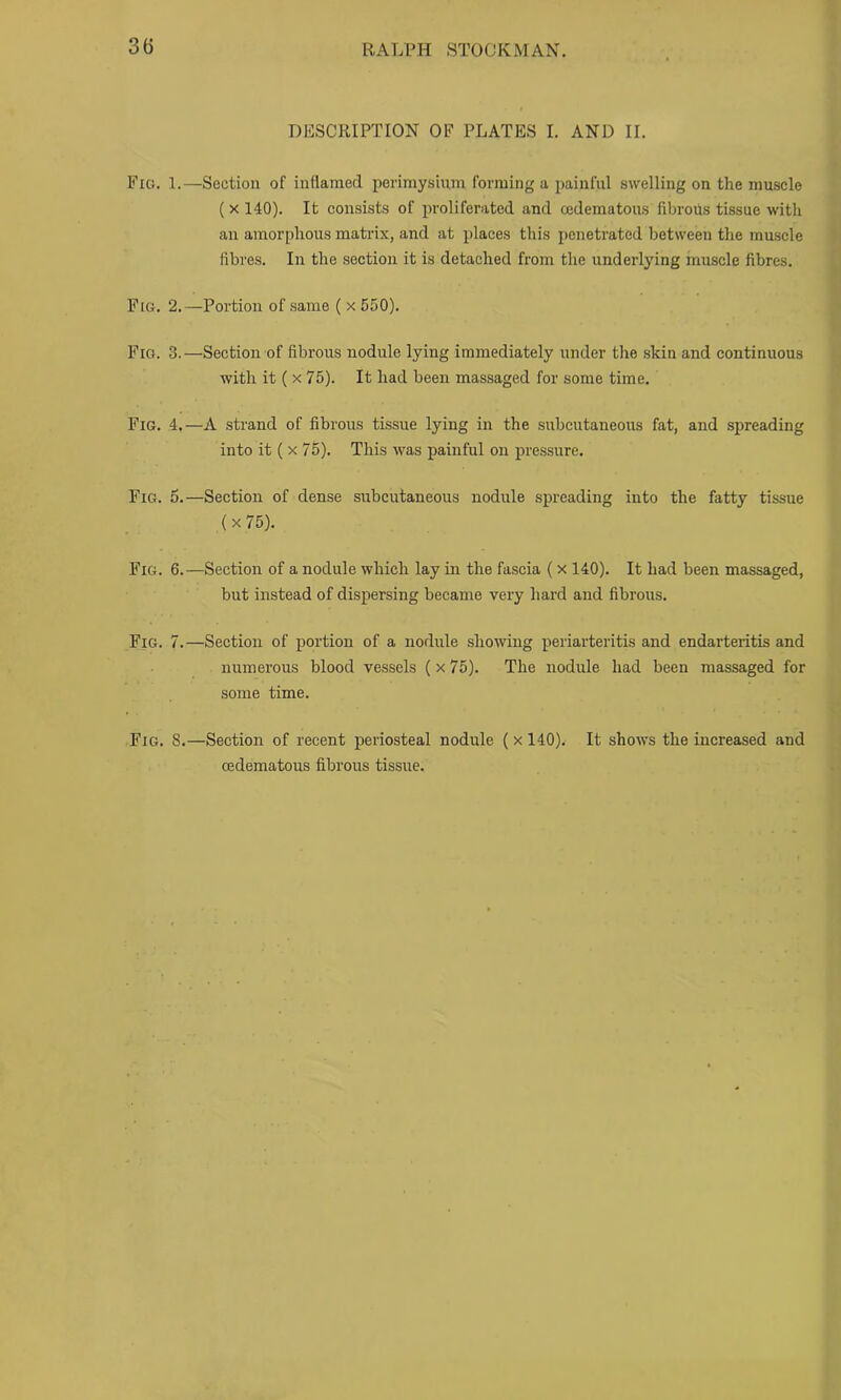 DESCRIPTION OF PLATES I. AND II. Fio. 1.—Section of inflamed perimysium forming a painful swelling on the muscle (X 140). It consists of proliferated and oedematous fibrous tissue with an amorphous matrix, and at places this penetrated between the muscle fibres. In the section it is detached from the underlying muscle fibres. Fig. 2.—Portion of same ( x 550). Fig. 3.—Section of fibrous nodule lying immediately under the skin and continuous with it ( X 75). It had been massaged for some time. Fig. 4.—A strand of fibrous tissue lying in the subcutaneous fat, and spreading into it ( X 75). This was painful on pressure. Fig. 6.—Section of dense subcutaneous nodule spreading into the fatty tissue (x75). Fig. 6.—Section of a nodule which lay in the fascia ( x 140). It had been massaged, but instead of dispersing became very hard and fibrous. Fig. 7.—Section of portion of a nodule showing periarteritis and endarteritis and numerous blood vessels (x 75). The nodule had been massaged for some time. Fig. S.—Section of recent periosteal nodule (x 140). It shows the increased and oedematous fibrous tissue.