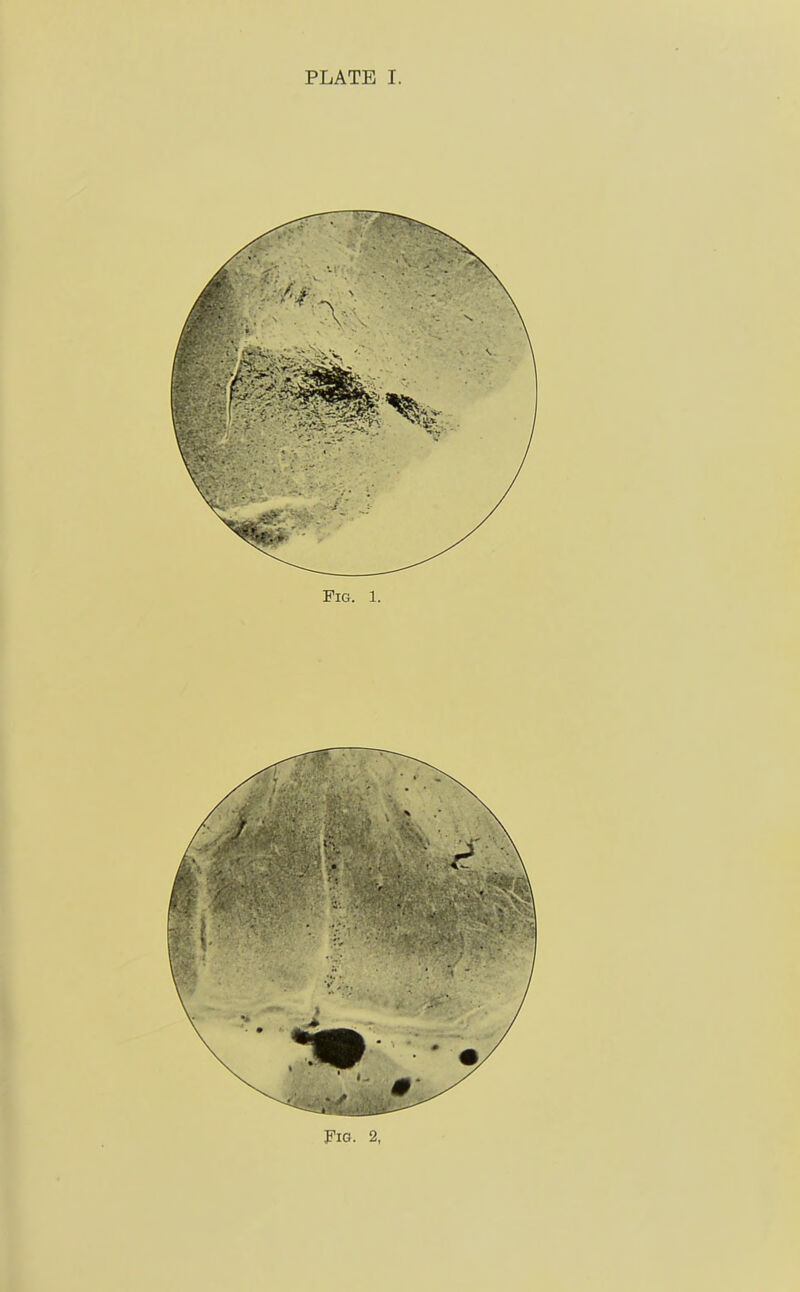 Pig. 1. Fig. 2,