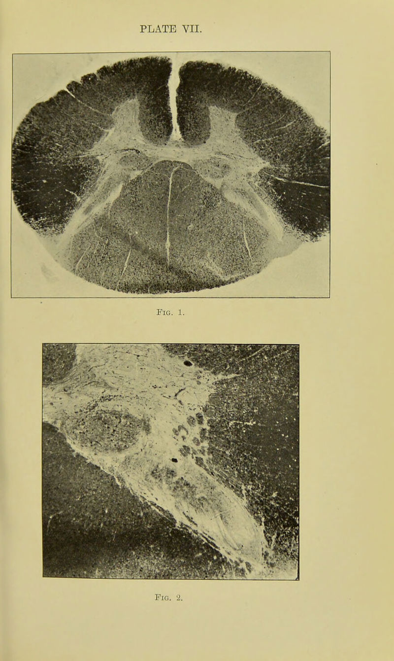 Fig. 1. Pig. 2.