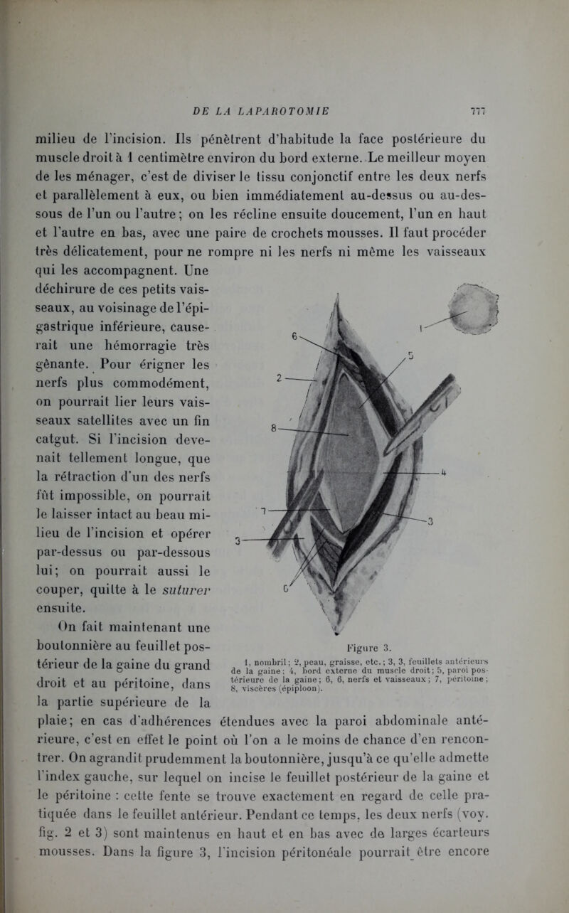 milieu de l’incision. Ils pénètrent d’habitude la face postérieure du muscle droit à 1 centimètre environ du bord externe. Le meilleur moyen de les ménager, c’est de diviser le tissu conjonctif entre les deux nerfs et parallèlement à eux, ou bien immédiatement au-dessus ou au-des- sous de l’un ou l’autre ; on les récline ensuite doucement, l’un en haut et l’autre en bas, avec une paire de crochets mousses. Il faut procéder très délicatement, pour ne rompre ni les nerfs ni même les vaisseaux qui les accompagnent. Une déchirure de ces petits vais- seaux, au voisinage de l’épi- gastrique inférieure, cause- rait une hémorragie très gênante. Pour érigner les nerfs plus commodément, on pourrait lier leurs vais- seaux satellites avec un fin catgut. Si l’incision deve- nait tellement longue, que la rétraction d’un des nerfs fût impossible, on pourrait le laisser intact au beau mi- lieu de l’incision et opérer par-dessus ou par-dessous lui; on pourrait aussi le couper, quitte à le suturer ensuite. On fait maintenant une boutonnière au feuillet pos- térieur de la gaine du grand droit et au péritoine, dans la partie supérieure de la plaie; en cas d’adhérences étendues avec la paroi abdominale anté- rieure, c’est en effet le point où l’on a le moins de chance d’en rencon- trer. On agrandit prudemment la boutonnière, jusqu’à ce qu’elle admette l'index gauche, sur lequel on incise le feuillet postérieur de la gaine et le péritoine : cette fente se trouve exactement en regard de celle pra- tiquée dans le feuillet antérieur. Pendant ce temps, les deux nerfs (voy. fig. 2 et 3) sont maintenus en haut et en bas avec de larges écarteurs mousses. Dans la figure 3, l'incision péritonéale pourrait être encore Figure 3. 1, nombril; ‘J, peau, graisse, etc.; 3, 3, feuillets antérieurs de la gaine; 4, bord externe du muscle droit; 5, paroi pos- térieure de la gaine ; 6, 6, nerfs et vaisseaux ; 7, péritoine ; 8, viscères (épiploon).