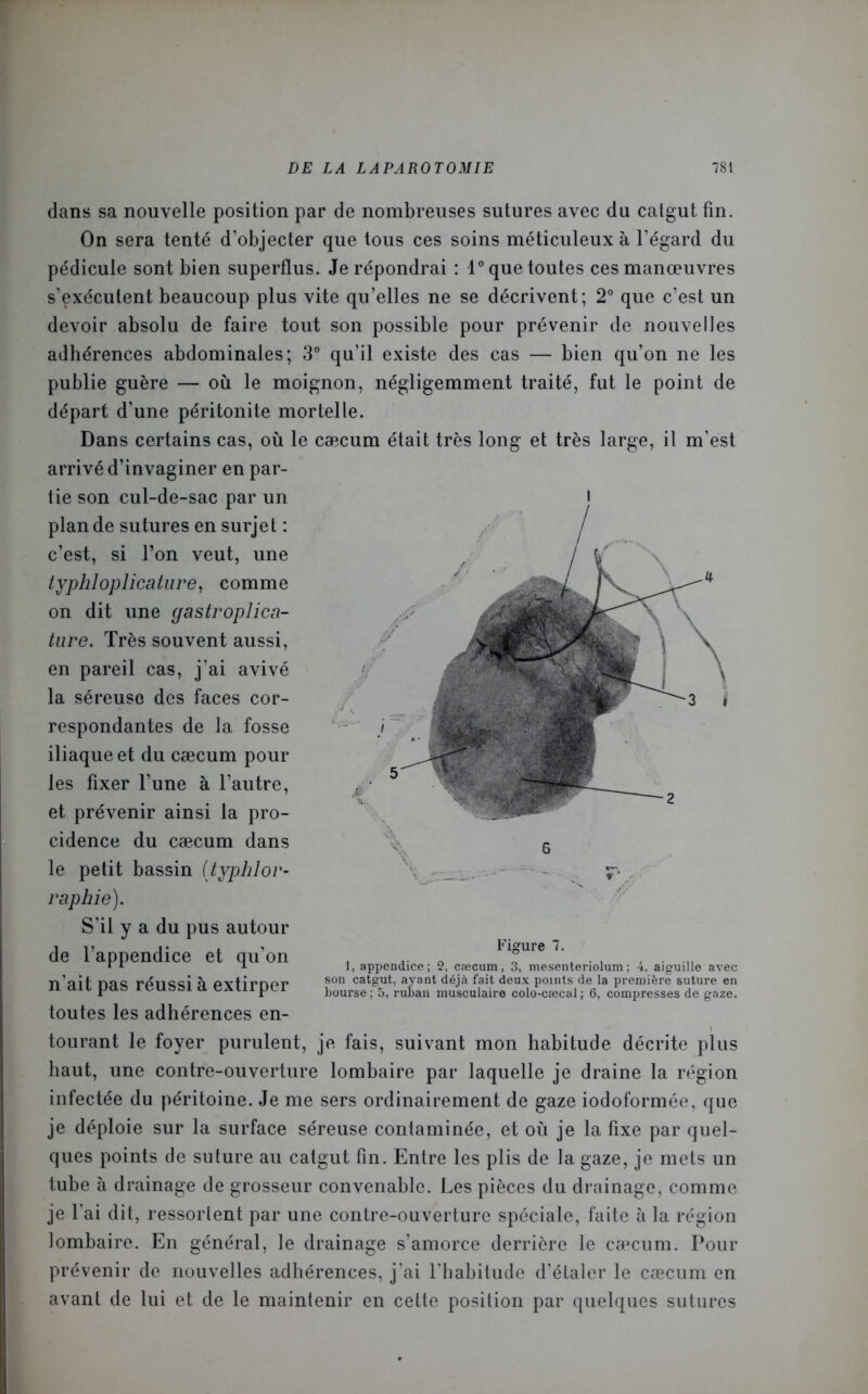 dans sa nouvelle position par de nombreuses sutures avec du catgut fin. On sera tenté d’objecter que tous ces soins méticuleux à l’égard du pédicule sont bien superflus. Je répondrai : 1° que toutes ces manœuvres s’exécutent beaucoup plus vite qu’elles ne se décrivent; 2° que c’est un devoir absolu de faire tout son possible pour prévenir de nouvelles adhérences abdominales; 3° qu’il existe des cas — bien qu’on ne les publie guère — où le moignon, négligemment traité, fut le point de départ d’une péritonite mortelle. Dans certains cas, où le cæcum était très long et très large, il m'est arrivé d’invaginer en par- tie son cul-de-sac par un plan de sutures en surjet : c’est, si l’on veut, une lyphloplicature, comme on dit une gastroplica- ture. Très souvent aussi, en pareil cas, j'ai avivé la séreuse des faces cor- respondantes de la fosse iliaque et du cæcum pour les fixer l’une à l’autre, et prévenir ainsi la pro- cidence du cæcum dans le petit bassin (typlilor- raphie). S’il y a du pus autour de l’appendice et qu’on n’ait pas réussi à extirper toutes les adhérences en- tourant le foyer purulent, je fais, suivant mon habitude décrite plus haut, une contre-ouverture lombaire par laquelle je draine la région infectée du péritoine. Je me sers ordinairement de gaze iodoformée, que je déploie sur la surface séreuse contaminée, et où je la fixe par quel- ques points de suture au catgut fin. Entre les plis de la gaze, je mets un tube à drainage de grosseur convenable. Les pièces du drainage, comme je l’ai dit, ressortent par une contre-ouverture spéciale, faite à la région lombaire. En général, le drainage s’amorce derrière le cæcum. Pour prévenir de nouvelles adhérences, j’ai l'habitude d’élaler le cæcum en avant de lui et de le maintenir en cette position par quelques sutures I // Figure 7. 1, appendice; 2, cæcum, 3, mesenteriolum; 4, aiguille avec son catgut, ayant déjà fait deux points de la première suture en bourse ; 5, ruban musculaire colo-cæcal ; 6, compresses de gaze.