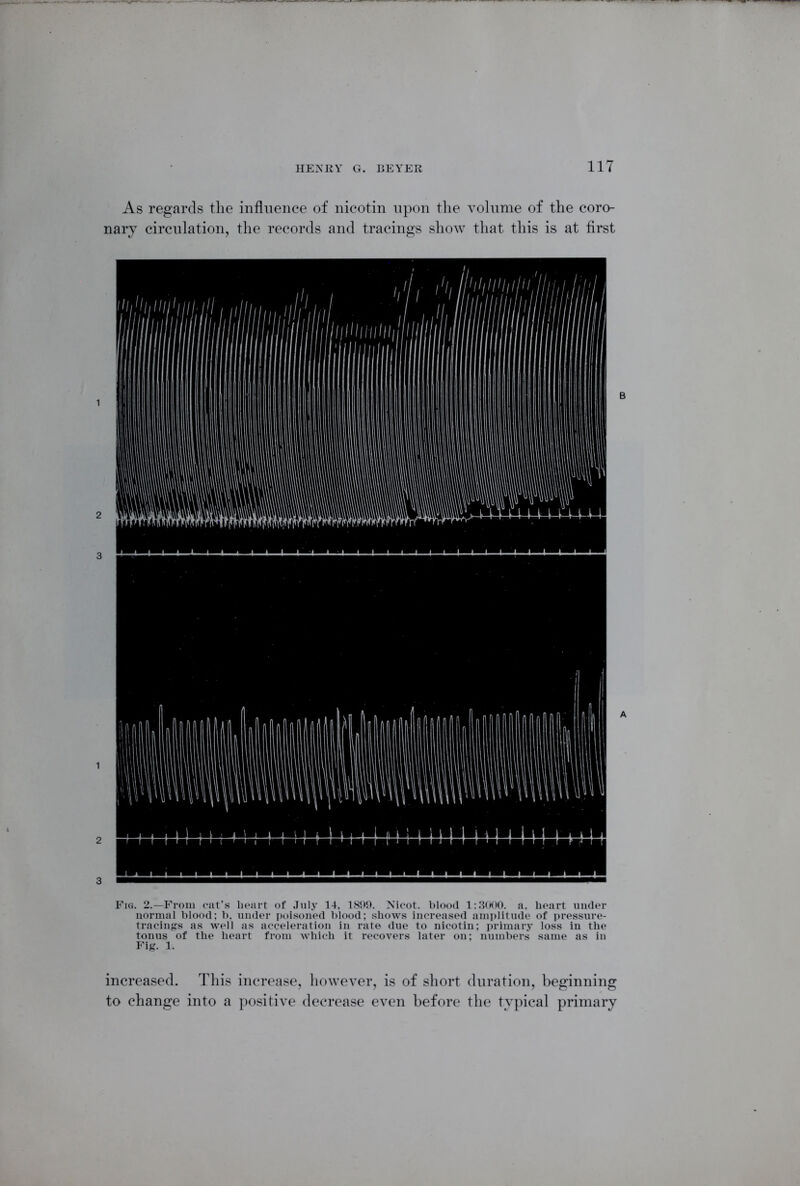 As regards the influence of nicotin upon the volume of the coro- nary circulation, the records and tracings show that this is at first Fig. 2.—From oat’s heart of July 14, 1899. Nicot. blood 1:3000. a. heart under normal blood; b, under poisoned blood; shows increased amplitude of pressure- tracings as well as acceleration in rate due to nicotin; primary loss in the tonus of the heart from which it recovers later on; numbers same as in Fig. 1. increased. This increase, however, is of short duration, beginning to change into a positive decrease even before the typical primary