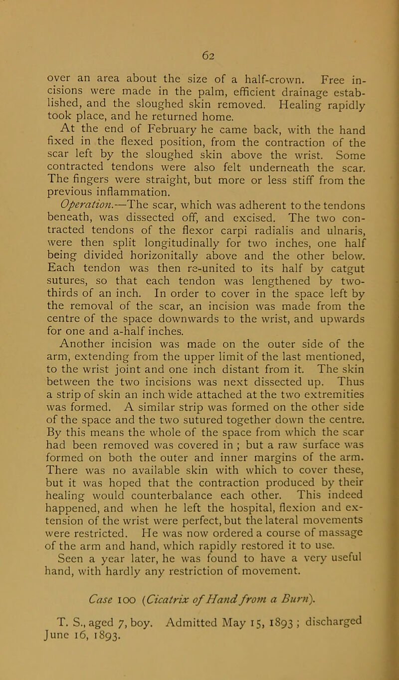 over an area about the size of a half-crown. Free in- cisions were made in the palm, efficient drainage estab- lished, and the sloughed skin removed. Healing rapidly took place, and he returned home. At the end of February he came back, with the hand fixed in the flexed position, from the contraction of the scar left by the sloughed skin above the wrist. Some contracted tendons were also felt underneath the scar. The fingers were straight, but more or less stiff from the previous inflammation. Operation.—The scar, which was adherent to the tendons beneath, was dissected off, and excised. The two con- tracted tendons of the flexor carpi radialis and ulnaris, were then split longitudinally for two inches, one half being divided horizontally above and the other below. Each tendon was then re-united to its half by catgut sutures, so that each tendon was lengthened by two- thirds of an inch. In order to cover in the space left by the removal of the scar, an incision was made from the centre of the space downwards to the wrist, and upwards for one and a-half inches. Another incision was made on the outer side of the arm, extending from the upper limit of the last mentioned, to the wrist joint and one inch distant from it. The skin between the two incisions was next dissected up. Thus a strip of skin an inch wide attached at the two extremities was formed. A similar strip was formed on the other side of the space and the two sutured together down the centre. By this means the whole of the space from which the scar had been removed was covered in ; but a raw surface was formed on both the outer and inner margins of the arm. There was no available skin with which to cover these, but it was hoped that the contraction produced by their healing would counterbalance each other. This indeed happened, and when he left the hospital, flexion and ex- tension of the wrist were perfect, but the lateral movements were restricted. He was now ordered a course of massage of the arm and hand, which rapidly restored it to use. Seen a year later, he was found to have a very useful hand, with hardly any restriction of movement. Case ioo (Cicatrix of Hand from a Burn). T. S., aged 7, boy. Admitted May 15, 1893 ; discharged June 16, 1893.