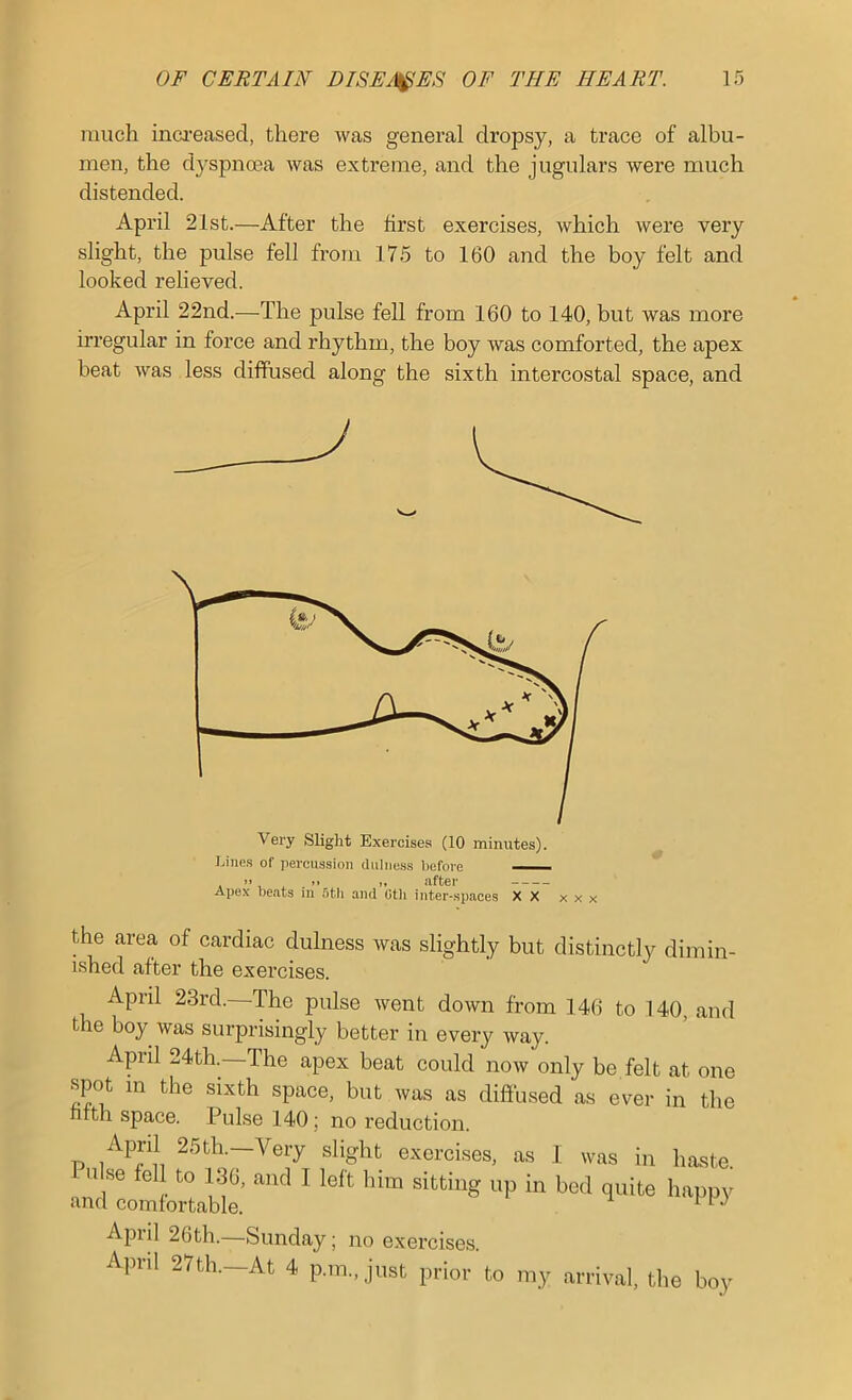 much inci’eased, there was general dropsy, a trace of albu- men, the dyspnoea was extreme, and the jugulars were much distended. April 21st.—After the first exercises, which were very slight, the pulse fell from 175 to 160 and the boy felt and looked relieved. April 22nd.-—The pulse fell from 160 to 140, but was more irregular in force and rhythm, the boy was comforted, the apex beat was less diffused along the sixth intercostal space, and Jjines of jiercussion cliUness before —— , .. iifter Apex beats m 6th and Otli inter-spaces XX x x x the area of cardiac dulness was slightly but distinctly dimin- ished after the exercises. April 23rd. The pulse went down from 146 to 140, and the boy was surprisingly better in every way. April 24th.—The apex beat could now only be felt at one spot m the sixth space, but was as diftused as ever in the hfth space. Pulse 140; no reduction. April 2Sth._Very slight exorcises, as ,1 was in haste Pulse fel to 1.30, and I loft him sitting up in bed quite happy and comfortable. April 26th.—Sunday; no exercises. April 27th.—At 4 p.m., just prior to my arrival, the boy