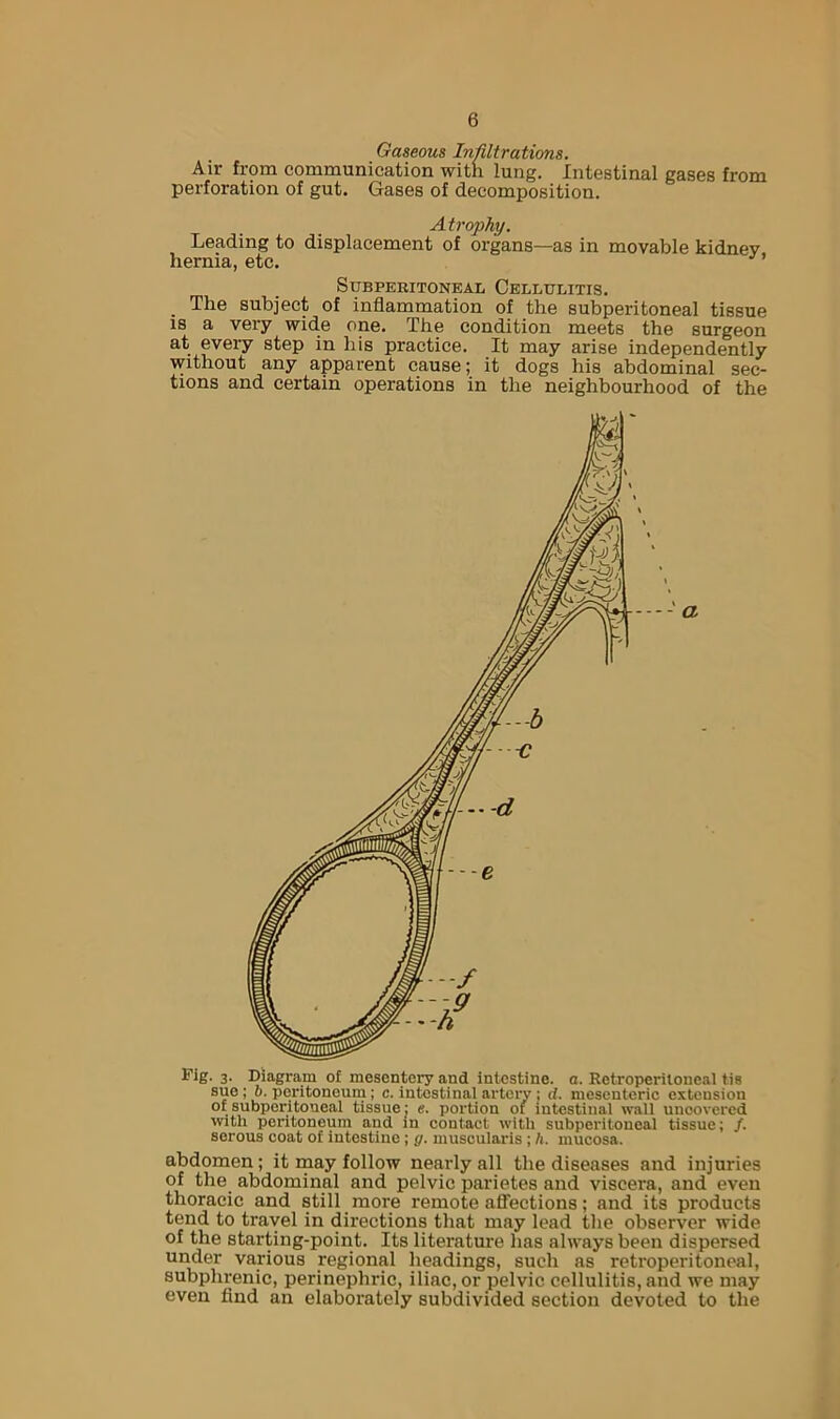 Gaseous Infiltrations. Air from communication with lung. Intestinal gases from perforation of gut. Gases of decomposition. Atrophy. Leading to displacement of organs—as in movable kidney hernia, etc. ’ SUBPERITONEAL CELLULITIS. _ The subject of inflammation of the subperitoneal tissue IS a very wide one. The condition meets the surgeon at every step in his practice. It may arise independently without any apparent cause; it dogs his abdominal sec- tions and certain operations in the neighbourhood of the Fig. 3. Diagram of mesentery and intestine, a. Retroperitoneal tis sue; 6. peritoneum; c. intestinal artery ; d. mesenteric extension of subperitoneal tissue: e. portion of intestinal wall uncovered with peritoneum and in contact with subperitoneal tissue; f. serous coat of intestine ; g. musoularis ; h. mucosa. abdomen; it may follow nearly all the diseases and injuries of the abdominal and pelvic parietes and viscera, and even thoracic and still more remote aflections; and its products tend to travel in directions that may lead the observer wide of the starting-point. Its literature has always been dispersed ur^er various regional headings, such as retroperitoneal, subphrenic, perinephric, iliac, or pelvic cellulitis, and we may even find an elaborately subdivided section devoted to the