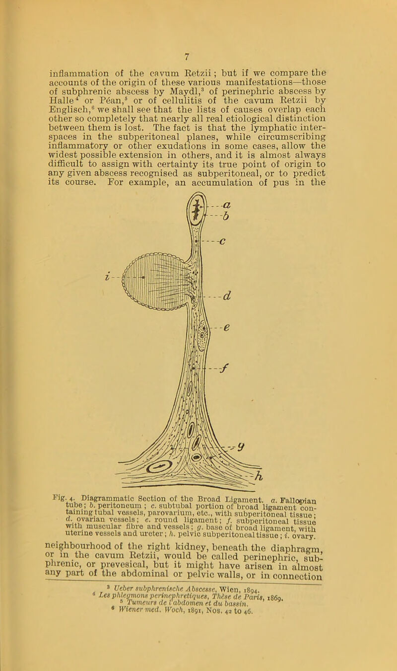 inflammation of the cavum Eetzii; but if we compare the accounts of the origin of these various manifestations—tliose of subphrenic abscess by Maydl,^ of perinephric abscess by Halle or P6an,“ or of cellulitis of the cavum Retzii by Englisch,® we shall see that the lists of causes overlap each other so completely that nearly all real etiological distinction between them is lost. The fact is that the lymphatic inter- spaces in the subperitoneal planes, while circumscribing inflammatory or other exudations in some cases, allow the widest possible extension in others, and it is almost always diflicult to assign with certainty its true point of origin to any given abscess recognised as subperitoneal, or to predict its course. For example, an accumulation of pus in the 1' ig. 4. Diagrammatic Section of the Broad Ligament, a. FallojJian tube ; 6. peritoneum ; c. subtubal portion of broad ligament con- taining fubal vessels, parovarium, etc., with subperitoneal tissue- d. ovarian vessels; e. round ligament; /. subperitoneal tissue with muscular fibre and vessels; p. base of broad ligament with uterine vessels and ureter; /i. pelvic subperitoneal tissue; i. ovary neighbourhood of the right kidney, beneath the diaphragm or in the cavum Retzii, would be called perinephric, sub- phrenic, or prevesical, but it might have arisen in almost any part of the abdominal or pelvic walls, or in connection 3 Ueber aubphrenuche Absccsse,Vfi<irx, 1894. * Lea plUeymons perinephreliques, TMae de Paria, 1869 » Tumeura de I’abdomm ft du baaaiii. • Wiener med. Woch, 1891, Nos. 42 to 46.