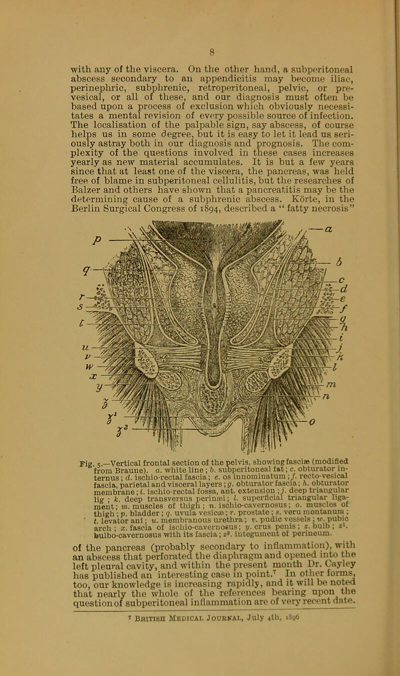 with any of the viscera. On the other hand, a subperitoneal abscess secondary to an appendicitis may become iliac, perinephric, subphrenic, retroperitoneal, pelvic, or pre- vesical, or all of these, and our diagnosis must often be based upon a process of exclusion which obviously necessi- tates a mental revision of every possible source of infection. The localisation of the palpable sign, say abscess, of course helps us in some degree, but it is easy to let it lead us seri- ously astray both in our diagnosis and prognosis. The com- plexity of the questions involved in these cases increases yearly as new material accumulates. It is but a few years since that at least one of the viscera, the pancreas, was held free of blame in subperitoneal cellulitis, but the researches of Balzer and others have shown that a pancreatitis may be the determining cause of a subphrenic abscess. Korte, in the Berlin Surgical Congress of 1894, described a “ fatty necrosis” Pig. 5.—Vertical frontal section of the pelvis, shelving fascias (modified from Braune). a. white line; b. suoperitoneal fat; c. obturator in- ternus; d. ischio-rectal fascia; e. os innominatum;/. recto-vesical fascia, parietal and visceral layers; g. obturator fascia; h. obturator membrane ;t. ischio-rectal fossa, ant. extension ;j. deep triangular lig ; k. deep transversus perinmi; 1. superficial triangular liga- ment; m. muscles of thigh; n. ischio-cavernosus; 0. muscles of thigh; p. bladder; q. uvula vesicas; r. prostate; s. veru montanum ; t. levator ani; u. membranous urethra; v. pudic vessels :«i. pubic arch ; x. fascia of ischio-cavernosus; y. crus penis ; e. bulb ; ih bulbo-cavornosus with its fascia; 2*. integument of perineum. of the pancreas (probably secondary to inflammation), with an abscess that perforated the diaphragm and opened into the left pleural cavity, and within the present month Dr. Cayley has published an interesting case in point.’' In other forms, too, our knowledge is increasing rapidly, and it will be noted that nearly the whole of the references bearing upon the question of subperitoneal inflammation are of veiy recent date. ’ Bamen Medical Jouhkal, July 4llh ^^96