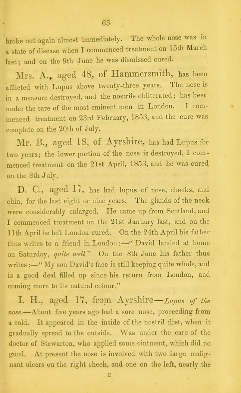 broke out again almost immediately. The whole nose was iii a state of disease when I commenced treatment on I5th March last; and on the 9th June he was dismissed cured. Mrs. A., aged 48, of Hammersmith, has been afflicted with Lupus above twenty-three years. The nose is in a measure destroyed, and the nostrils obliterated; has beei under the care of the most eminent men in London. I com- menced treatment on 23rd February, 1853, and the cure was complete on the 20th of July. Mr. B., aged 18, of Ayrshire, has had Lupus for two years; the lower portion of the nose is destroyed. I com- menced treatment on the 21st April, 1853, and he was cured on the 8th July. D. C., aged 17, has had lupus of nose, cheeks, and chin, for the last eight or nine years. The glands of the neck were considerably enlarged. He came up from Scotland, and I commenced treatment on the 21st January last, and on the 11th April he left London cured. On the 24th April his father thus writes to a friend in London:—“ David landed at home on Saturday, quite ivell. On the 8th June his father thus writes :—“ My son David’s face is still keeping quite whole, and is a good deal filled up since his return from London, and coming more to its natural colour.” I. H., aged 17, from Ayrshire—Luqms of the nose.—About five years ago had a sore nose, proceeding from a cold. It appeared in the inside of the nostril first, when it gradually spread to the outside. Was under the care of the doctor of Stewarton, who applied some ointment, which did no good. At present the nose is involved with two large malig- nant ulcers on the right cheek, and one on the left, nearly the E