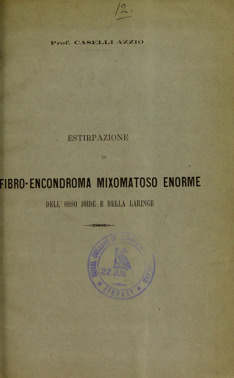r I>ror. CASELLI sì ESTIRPAZIONE DI FIERO-ENCONDROMA MIXOMATOSO ENORME DELL’ OSSO IOIDE E DELLA LARINGE
