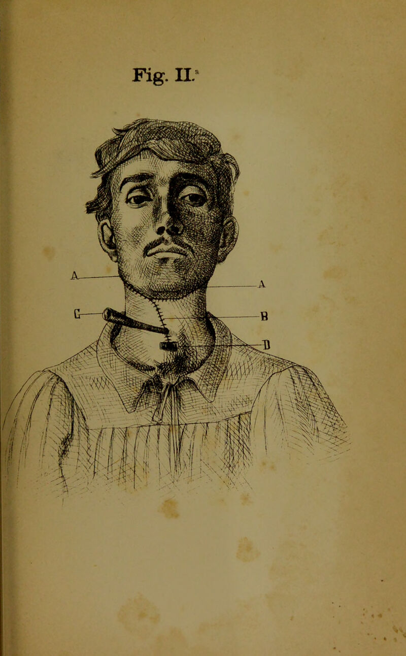 Fig. ir I 1 • ,v-V • •* • % %