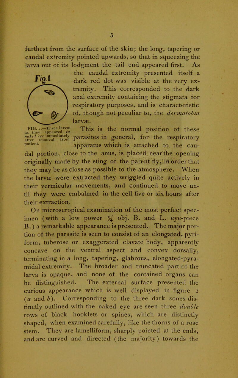 furthest from the surface of the skin; the long, tapering or caudal extremity pointed upwards, so that in squeezing the larva out of its lodgment the tail end appeared first. As the caudal extremity presented itself a dark red dot was visible at the very ex- tremity. This corresponded to the dark anal extremity containing the stigmata for respiratory purposes, and is characteristic of, though not peculiar to, the dermatobia larvas. FIG. IThree larvi This is the normal position of these afttr'^ parasites in general, for the respiratory apparatus which is attached to the cau- dal portion, close to the anus, is placed nearthe opening originally made by the sting of the parent fly,-iri order that they may be as close as possible to the atmosphere. When the larvae were extracted they wriggled quite actively in their vermicular movements, and continued to move un- til they were embalmed in the cell five or six hours after their extraction. On microscropical examination of the most perfect spec- imen (with a low power ^ obj. B. and L. eye-piece B.) a remarkable appearance is presented. The major por- tion of the parasite is seen to consist of an elongated, pyri- form, tuberose or exaggerated clavate body, apparently concave on the ventral aspect and convex dorsally, terminating in a long, tapering, glabrous, elongated-pyra- midal extremity. The broader and truncated part of the larva is opaque, and none of the contained organs can be distinguished. The external surface presented the curious appearance which is well displayed in figure 2 (a and b). Corresponding to the three dark zones dis' tinctly outlined with the naked eye are seen three double rows of black booklets or spines, which are distinctly shaped, when examined carefully, like the thorns of a rose stem. They are lamelliform, sharply pointed at the ends, and are curved and directed (the majority) towards the