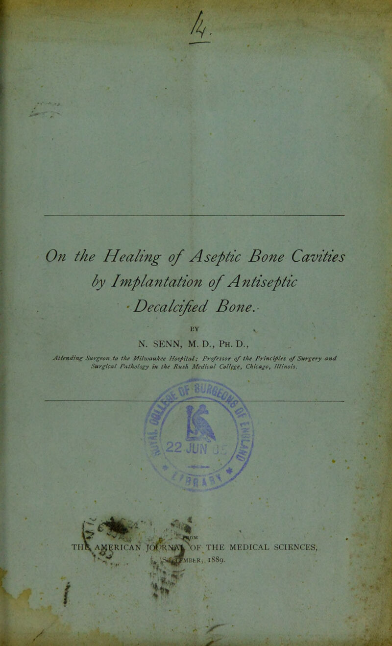 On the Healing of A septic Bone Cavities by Implantation of Antiseptic •Decalcified Bone,- BY N. SENN, M. D., Ph. D., AtimJing Surgeon to the Milwaukee Hospital; Professor of the Principles of Surgery and Surgical Pathology in the Rush Medical Collfge, Chicago, Illinois. TH\a^^RICAN \)F the 1889. MEDICAL SCIENCES,