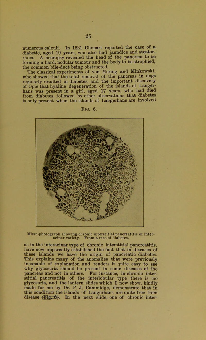 Dumerons calculi. In 1821 Ohopart reported the case of a diabetic, aged 19 years, who also had jaundice and steator- rboea. A necropsy revealed the head of the pancreas to be forming a hard, nodular tumour and the body to be atrophied, the common bile-duct being obstructed. The classical experiments of von Mering and Minkowski, who showed that the total removal of the pancreas in dogs regularly resulted in diabetes, and the important discovery of Opie that hyaline degeneration of the islands of Langer- hans was present in a girl, aged 17 years, who had died from diabetes, followed by other observations that diabetes is only present when the islands of Langerhans are involved Fig. 6. Micro-photograph showing chronic interstitial pancreatitis of inter- acinar variety. From a case of diabetes. as in the interacinar type of chronic interstitial pancreatitis, have now apparently established the fact that in diseases of these islands we have the origin of pancreatic diabetes. This explains many of the anomalies that were previously incapable of explanation and renders it quite easy to see why glycosuria should be present in some diseases of the pancreas and not in others. For instance, in chronic inter- stitial pancreatitis of the interlobular type there is no glycosuria, and the lantern slides which I now show, kindly made for me by Dr. P. J. Cammidge, demonstrate that in this condition the islands of Langerhans are quite free from disease In the next slide, one of chronic inter-