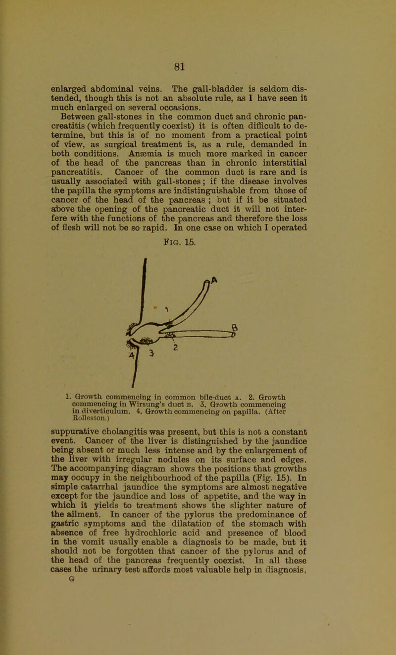 enlarged abdominal veins. The gall-bladder is seldom dis- tended, though this is not an absolute rule, as I have seen it much enlarged on several occasions. Between gall-stones in the common duct and chronic pan- creatitis (which frequently coexist) it is often diflBLcult to de- termine, but this is of no moment from a practical point of view, as surgical treatment is, as a rule, demanded in both conditions. Anasmia is much more marked in cancer of the head of the pancreas than in chronic interstitial pancreatitis. Cancer of the common duct is rare and is usually associated with gall-stones; if the disease involves the papilla the symptoms are indistinguishable from those of cancer of the head of the pancreas ; but if it be situated above the opening of the pancreatic duct it will not inter- fere with the functions of the pancreas and therefore the loss of flesh will not be so rapid. In one case on which I operated Fig. 16. 1. Growth commencing in common bile-duct a. 2. Growth Mmmencing in Wirsung’s duct B. 3. Growth commencing in diverticulum. 4. Growth commencing on papilla. (After Eolleston.) suppurative cholangitis was present, but this is not a constant event. Cancer of the liver is distinguished by the jaundice being absent or much less intense and by the enlargement of the liver with irregular nodules on its surface and edges. The accompanying diagram shows the positions that growths may occupy in the neighbourhood of the papilla (Fig. 15). In simple catarrhal jaundice the symptoms are almost negative except for the jaundice and loss of appetite, and the way in which it yields to treatment shows the slighter nature of the ailment. In cancer of the pylorus the predominance of gastric symptoms and the dilatation of the stomach with absence of free hydrochloric acid and presence of blood in the vomit usually enable a diagnosis to be made, but it should not be forgotten that cancer of the pylorus and of the head of the pancreas frequently coexist. In all these cases the urinary test affords most valuable help in diagnosis, G