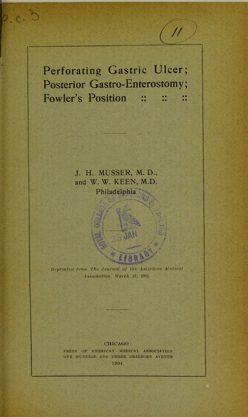 Perforating Gastric Ulcer; Posterior Gastro-Enterostomy; Fowler’s Position :: :: :: J. H. MUSSER, M. D., and W. W. KEEN, M.D. Axsooiatioii. Morch 12, 190). CHICAGO : PKESS OF AMBKICAN MBDICAL ASSOCIATION ONIO HONDBWD AND THREE DEARBORN AVENUE 1904.