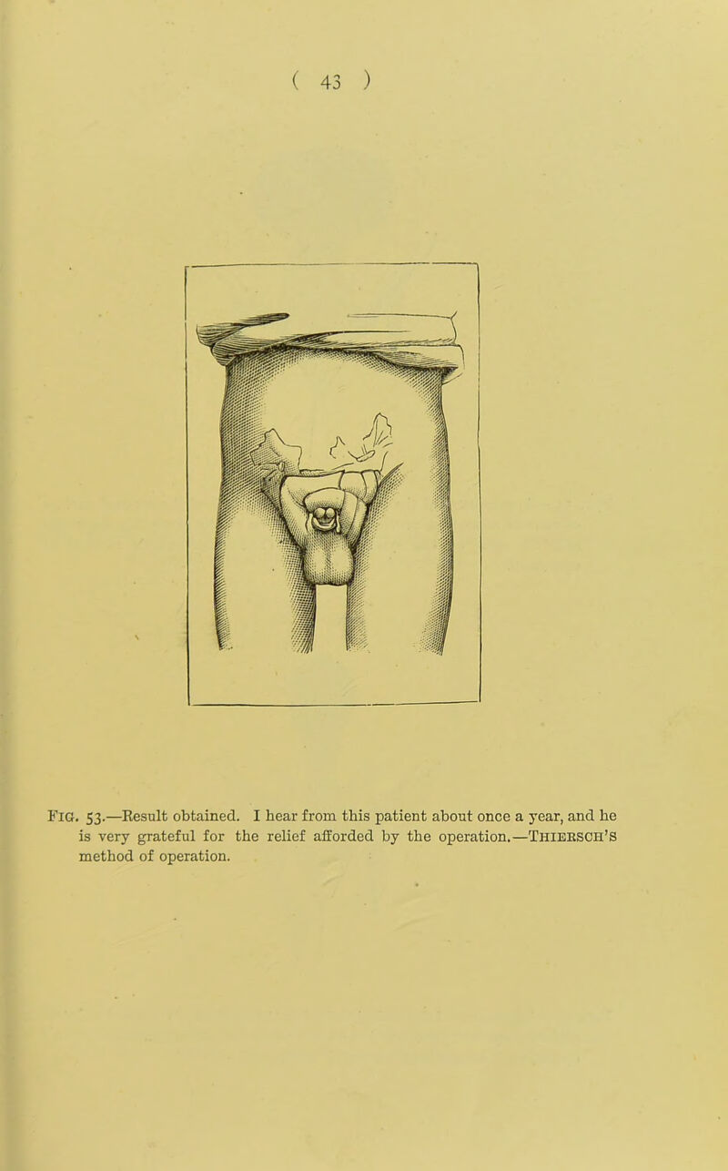 Fig. 53.—Result obtained. I hear from this patient about once a year, and he is very grateful for the relief afforded by the operation.—Thiebsch’S method of operation.