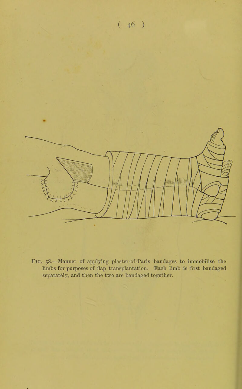 Fig. 58.—Manner of applying plaster-of-Paris bandages to immobilise the limbs for purposes of flap transplantation. Each limb is first bandaged separately, and then the two are bandaged together.