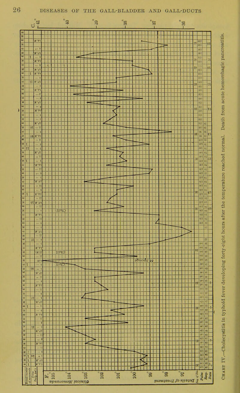 Chart IV.—Cholecystitis in typhoid fever developing forty-eight hours after the temperature reached normal. Death from acute hemorrhagic pancreatitis.